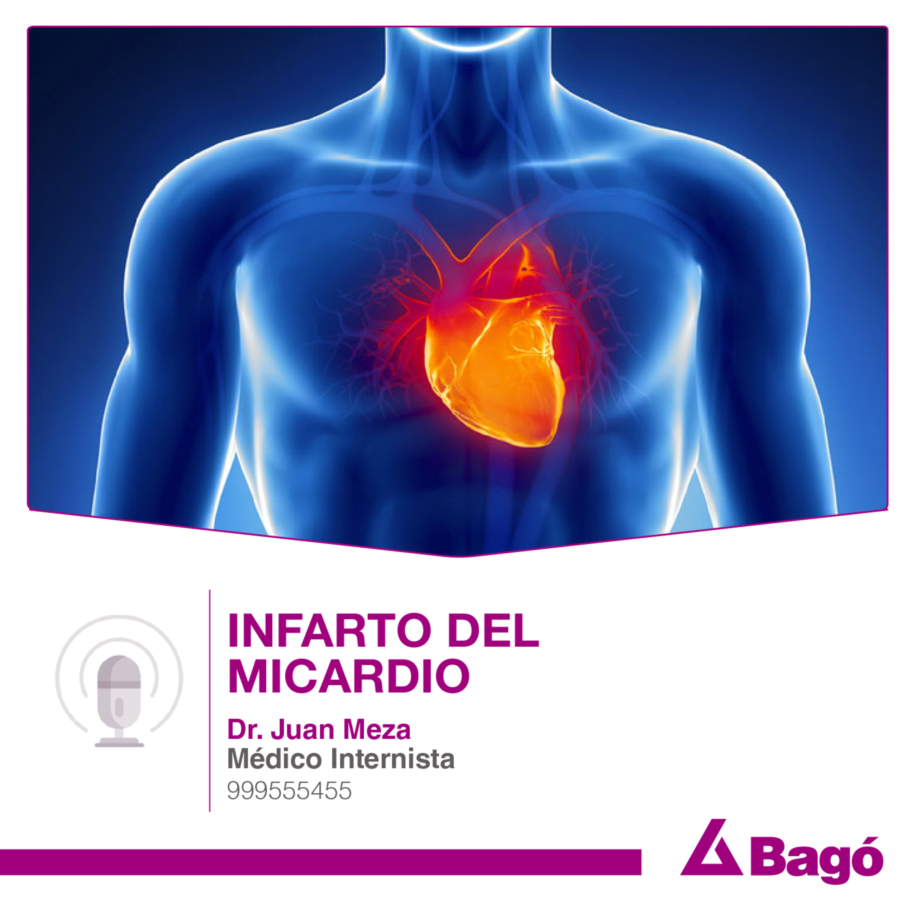 INFARTO DE MIOCARDIO episode artwork