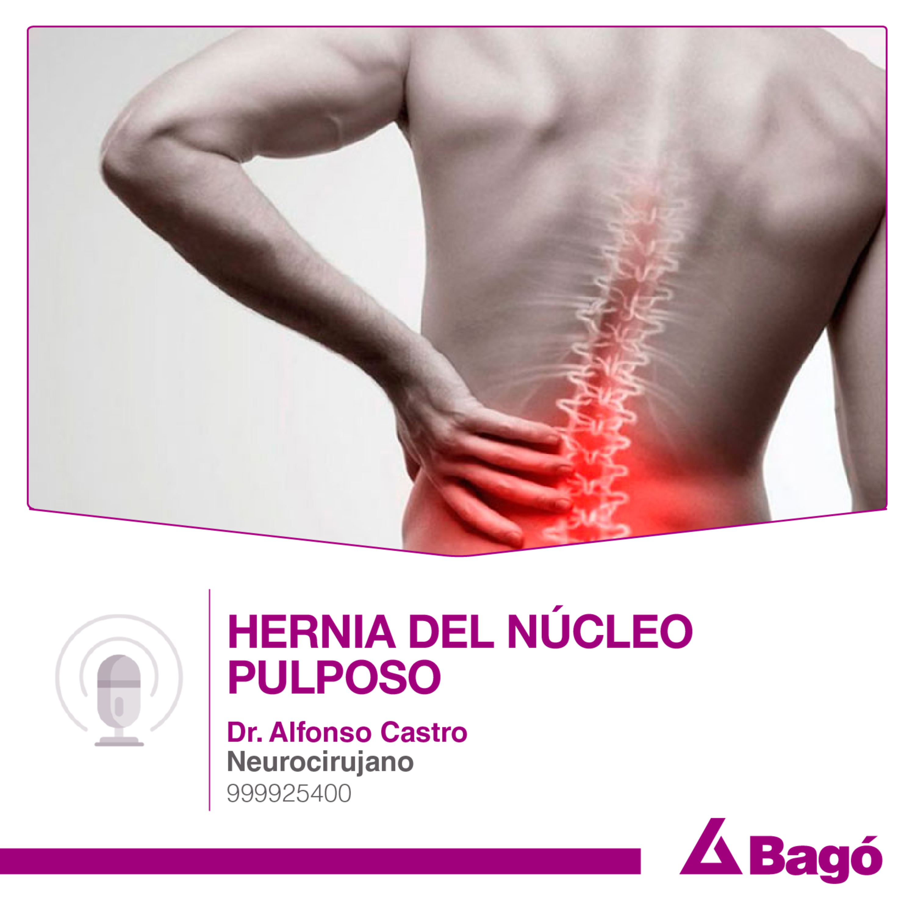 HERNIA DEL NÚCLEO PULPOSO episode artwork