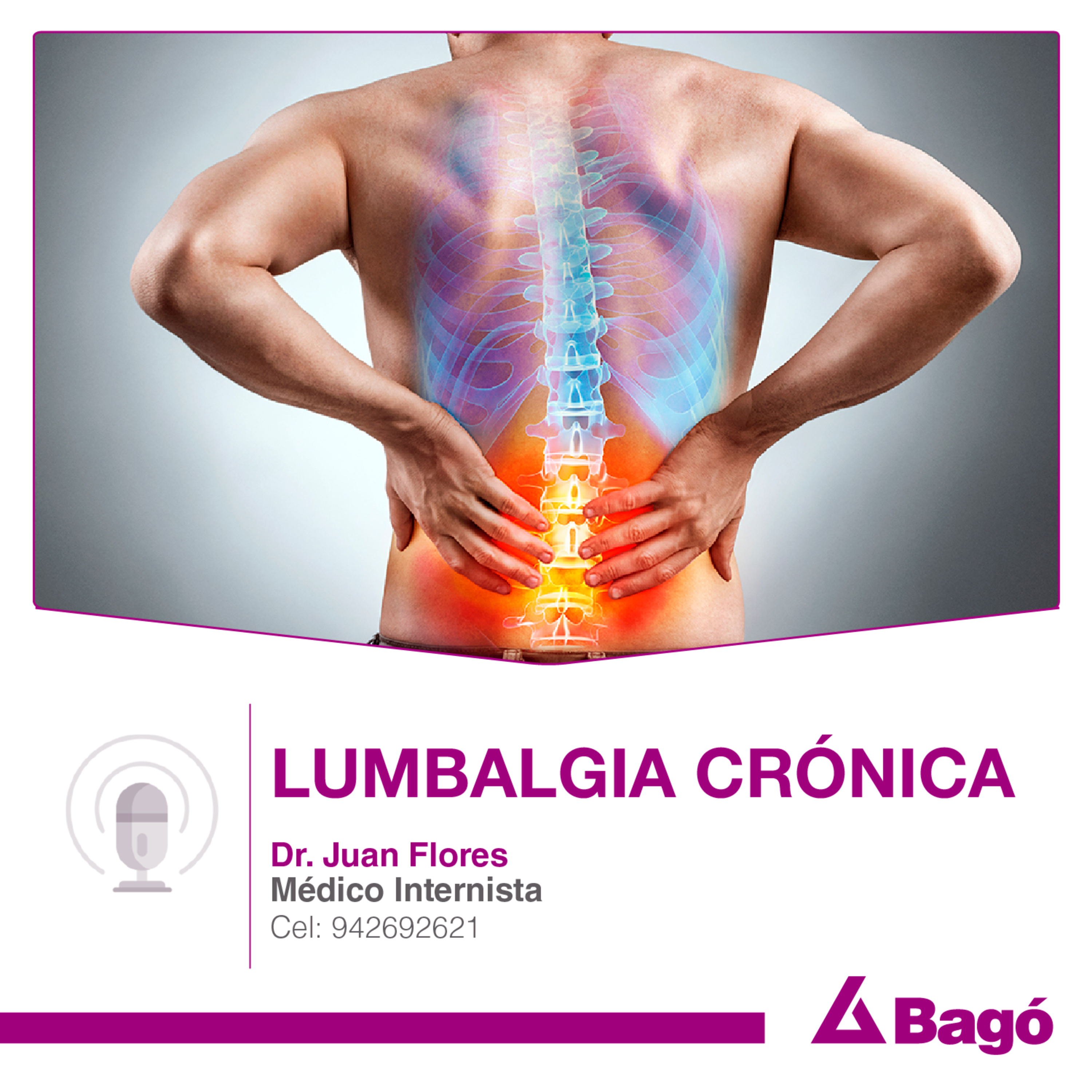LUMBALGIA CRÓNICA episode artwork