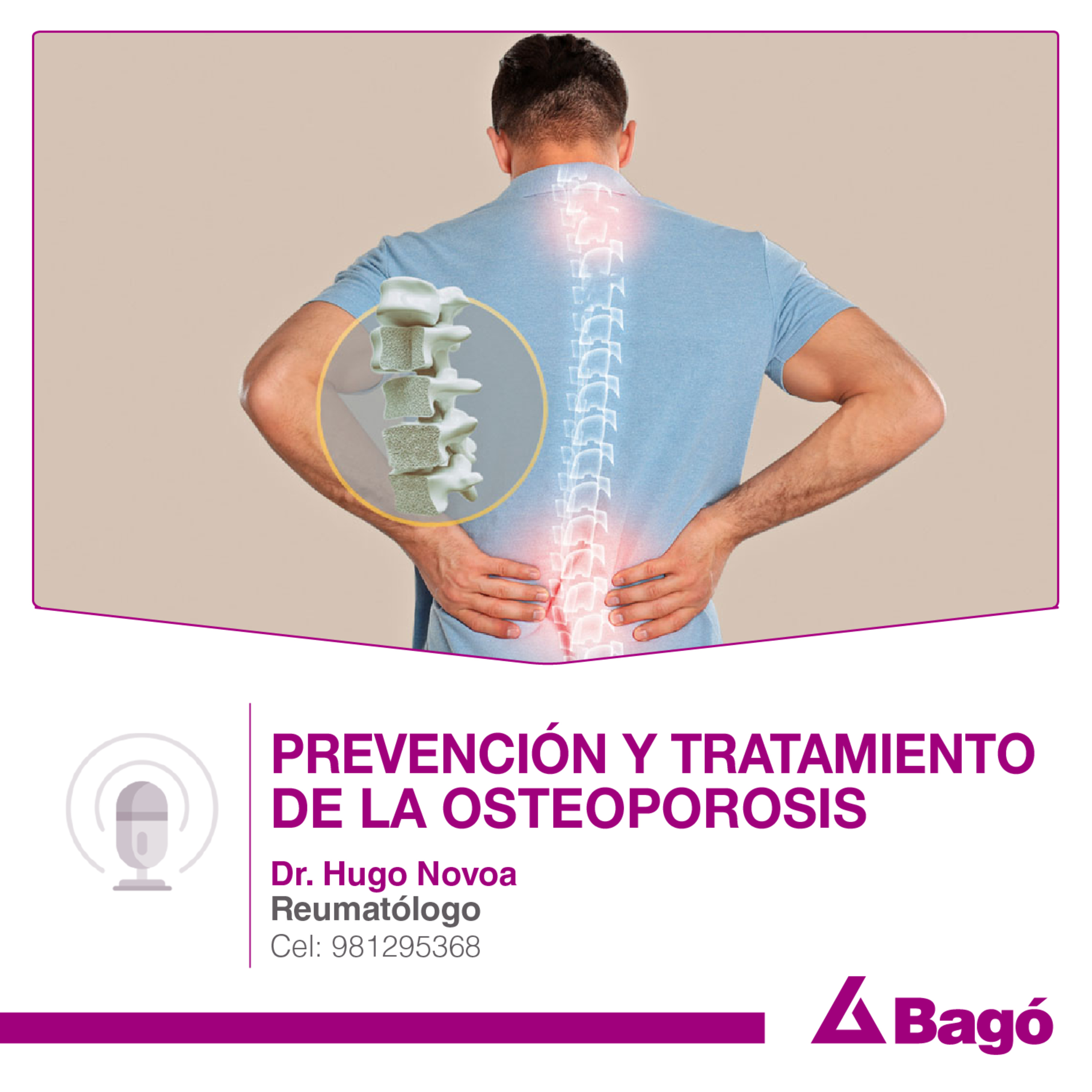 PREVENCIÓN Y TRATAMIENTO DE LA OSTEOPOROSIS episode artwork