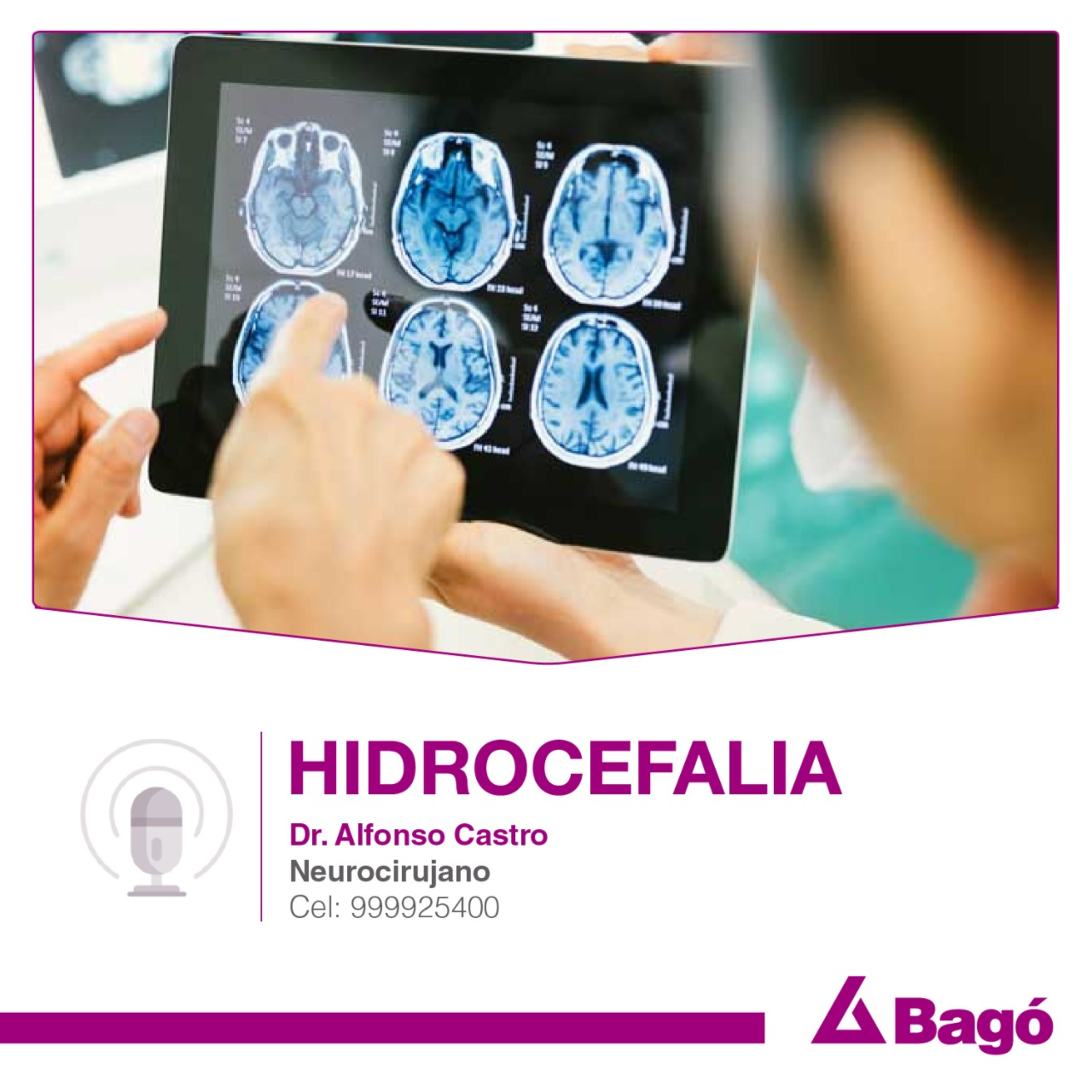 HIDROCEFALIA episode artwork
