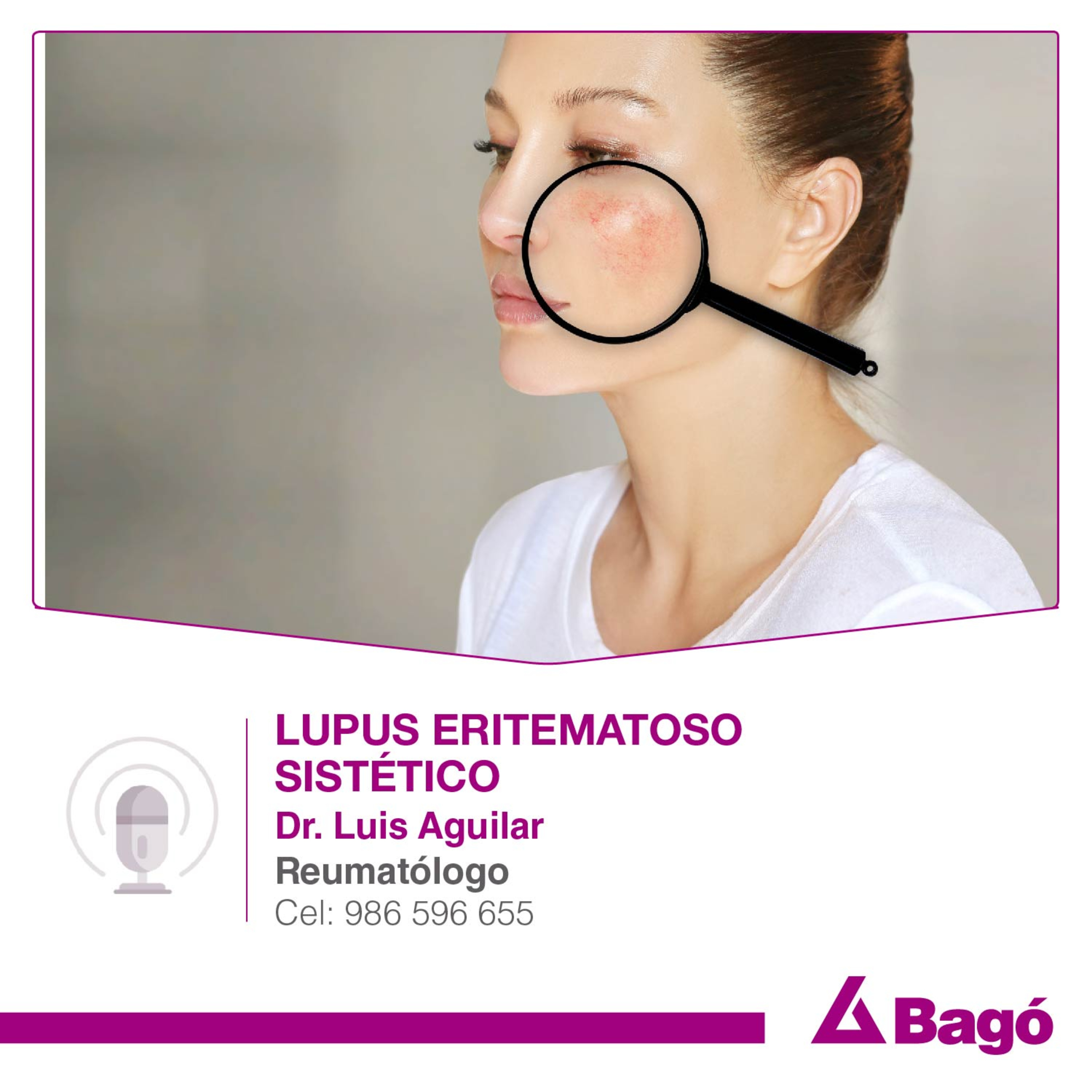 LUPUS ERITEMATOSO SISTÉMICO episode artwork