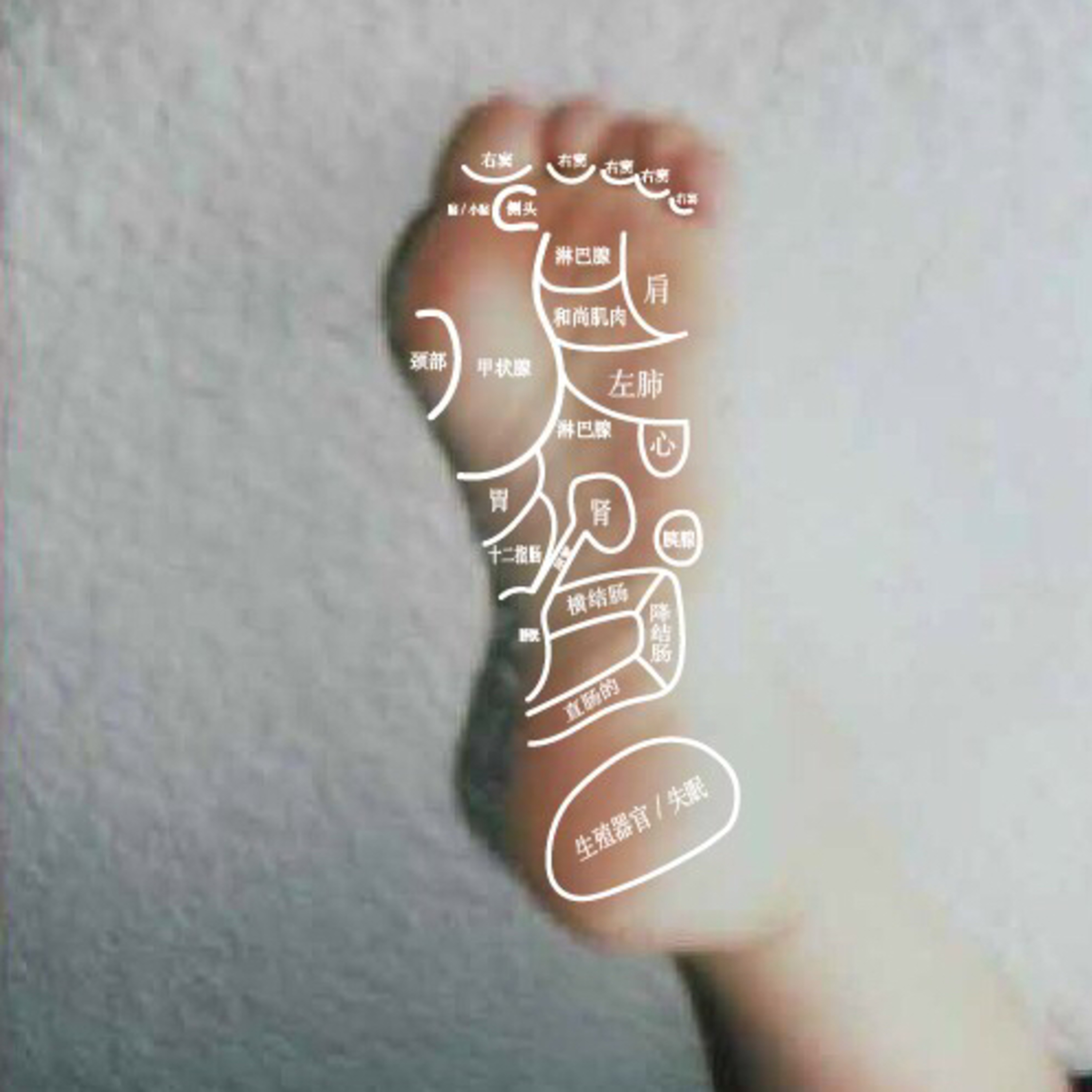 PMSとSNS episode artwork