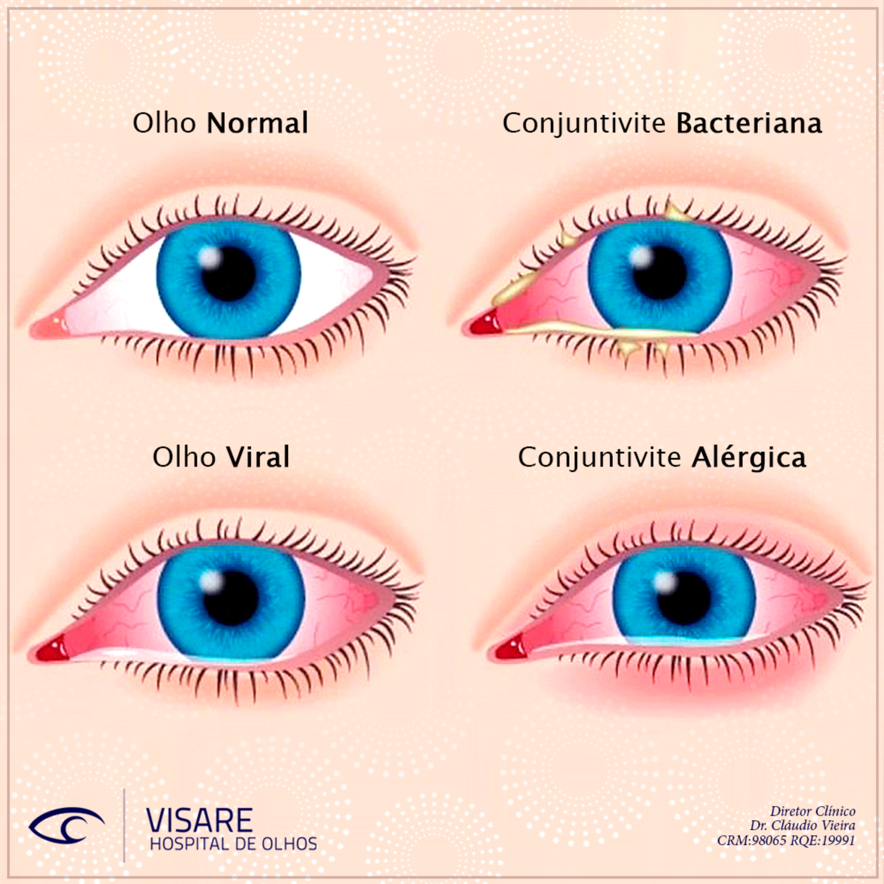 Visare Hospital de Olhos