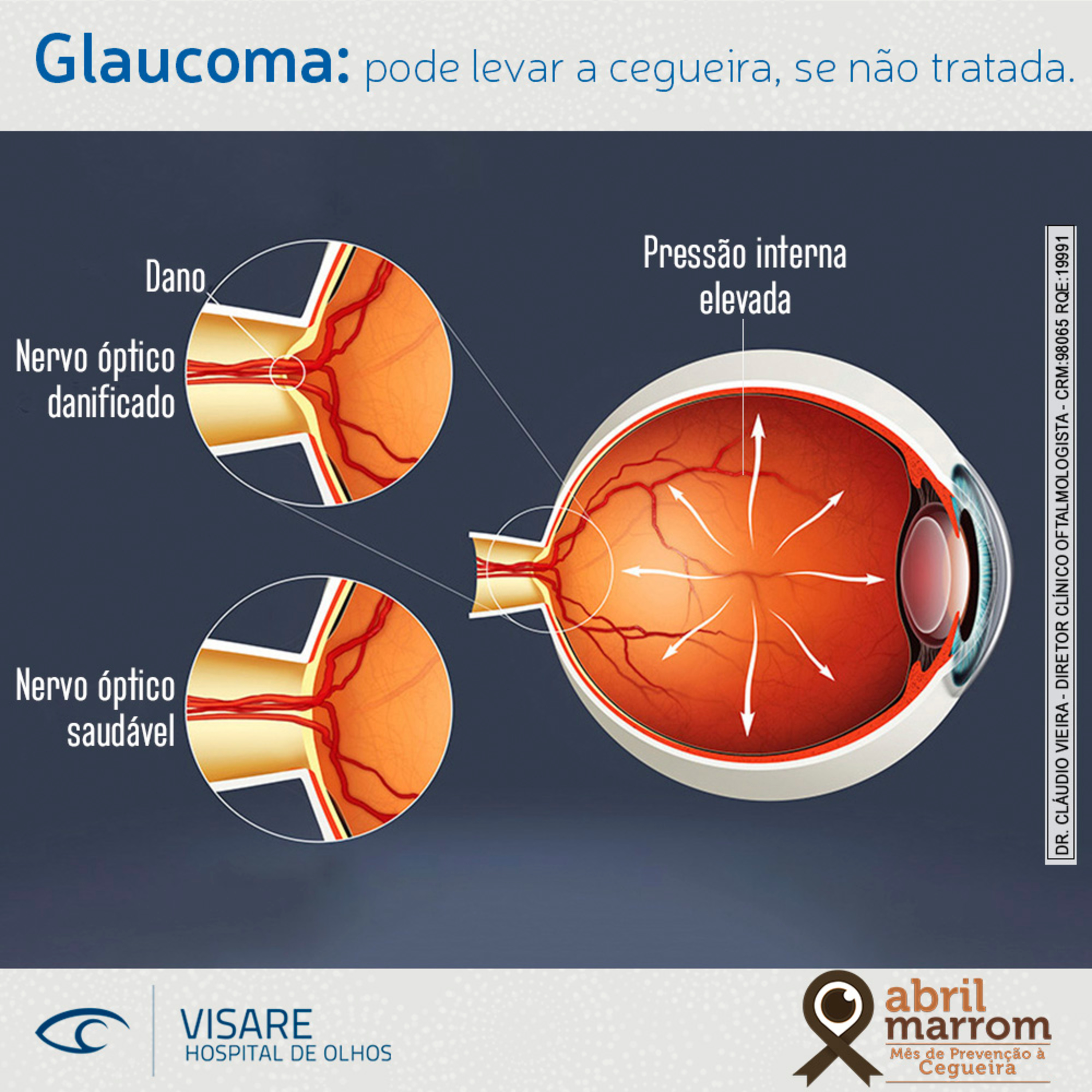 Visare Hospital de Olhos