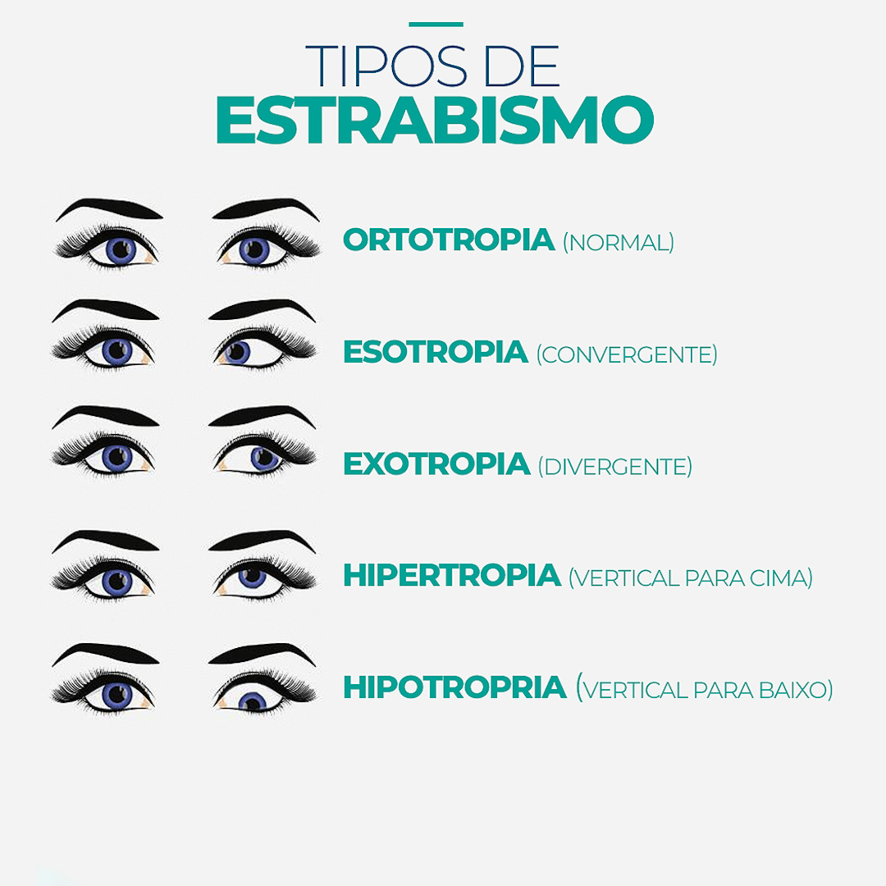 Visare Hospital de Olhos