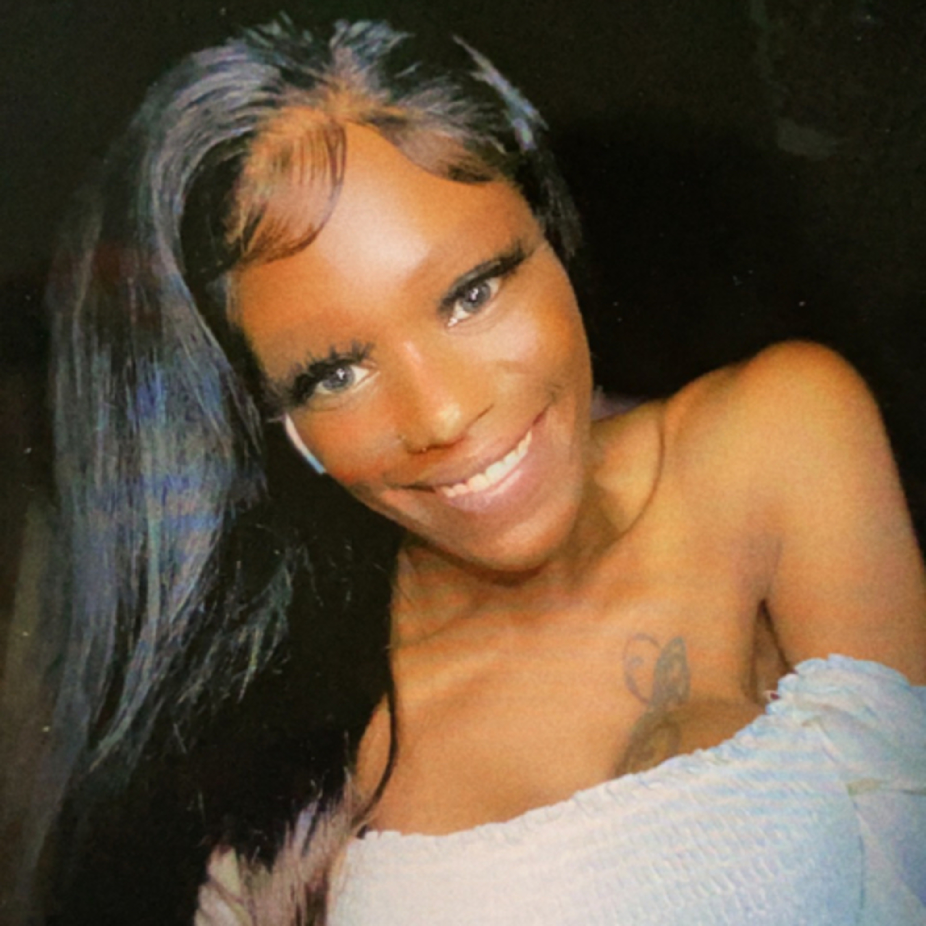 Breast Surgery