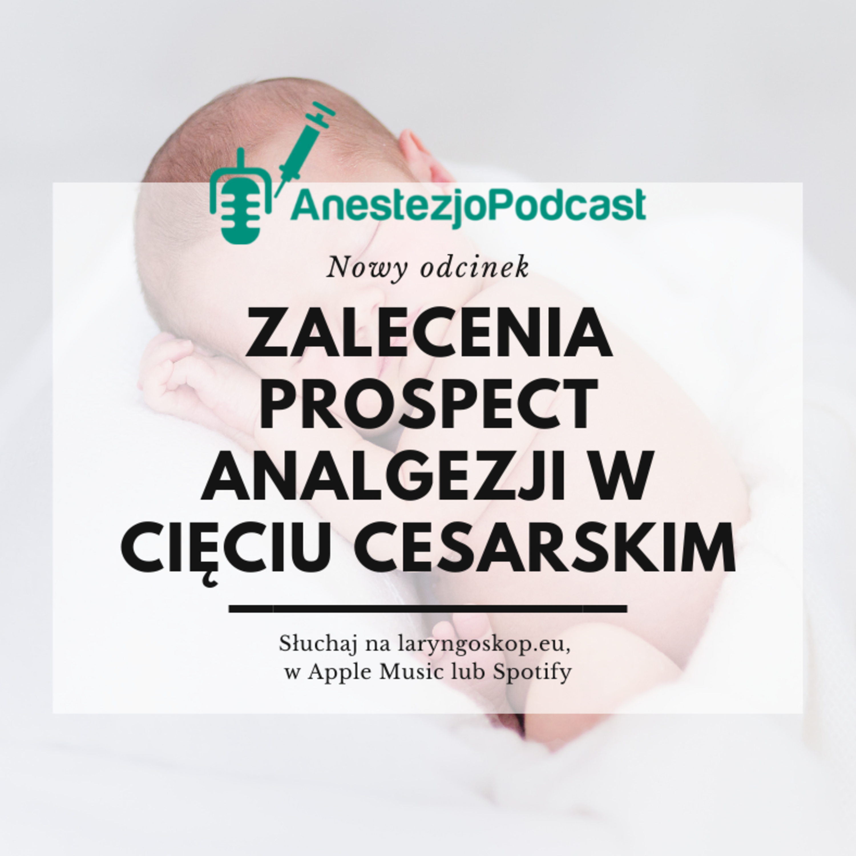 Odcinek 88 - Wytyczne PROSPECT analgezji w planowym cięciu cesarskim