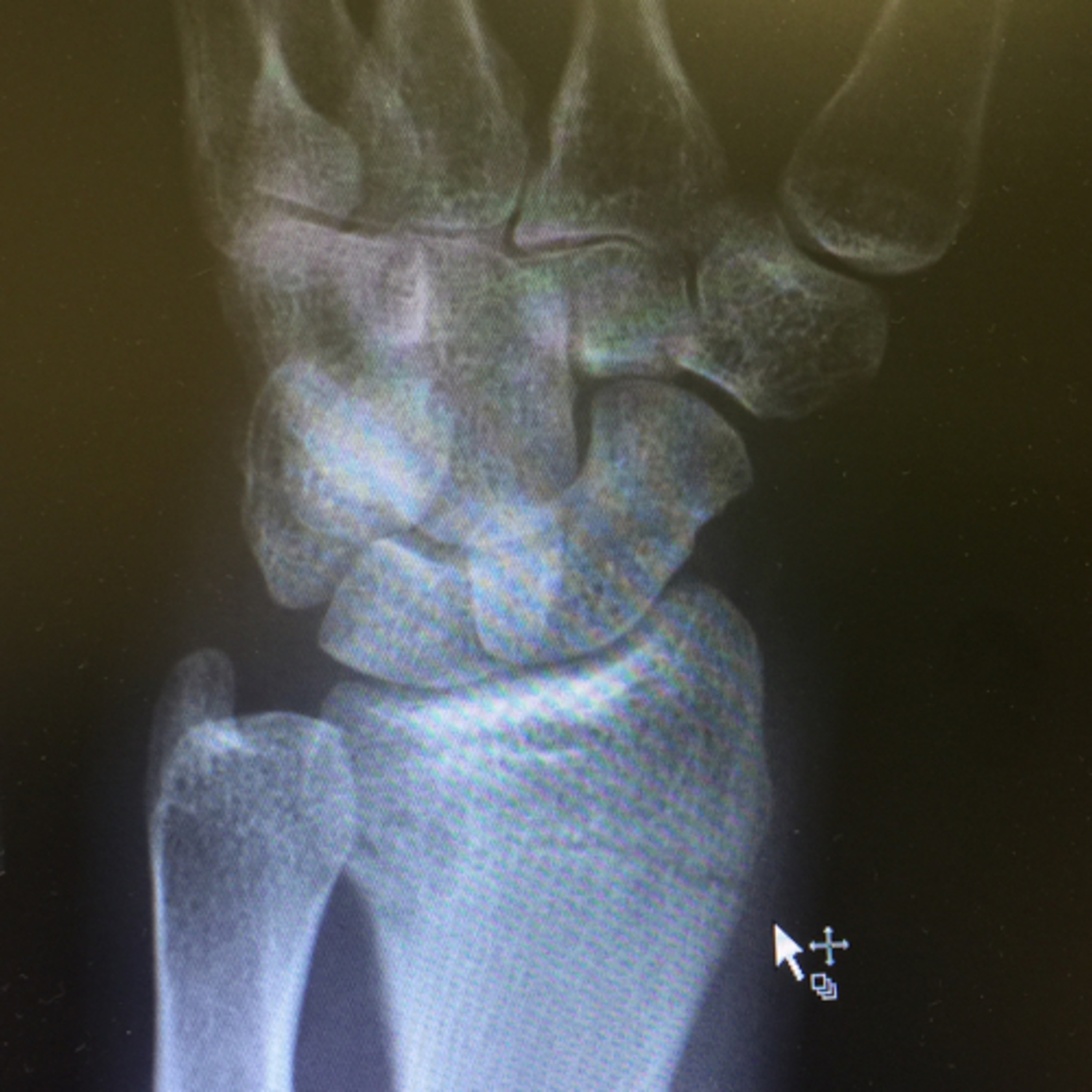 Ben Arkell | Passive Automation & Affiliate Marketing