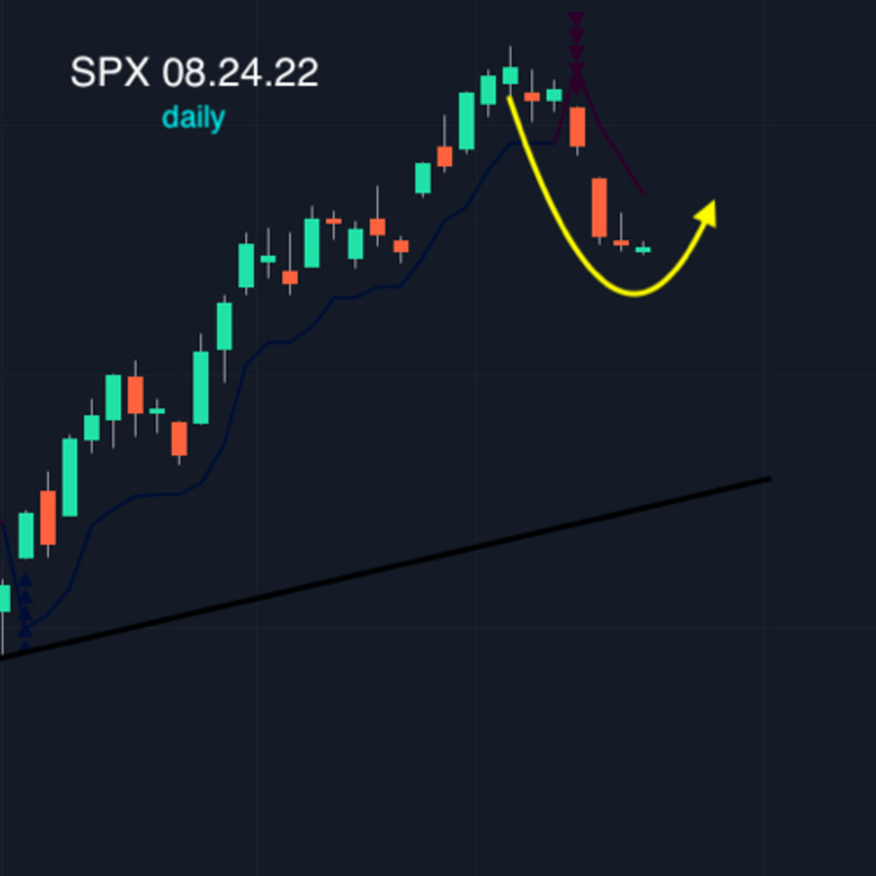Day Trading SPY Options In The Stock Market For Profit The Smart Way To Fast Money Live The Dream 🇺🇸💰 episode artwork