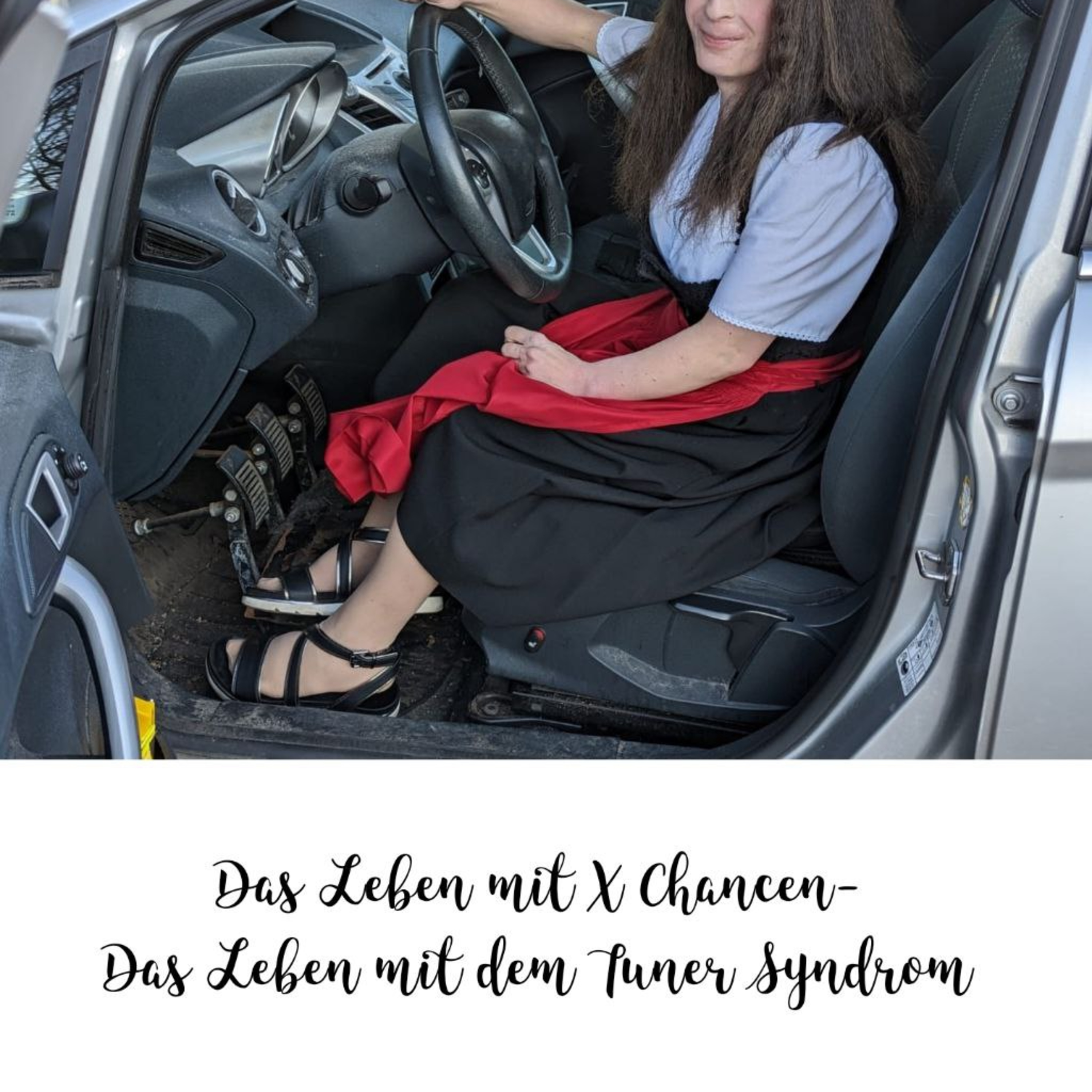 Das Leben mit X Chancen - Das Leben mit dem Turner Syndrom