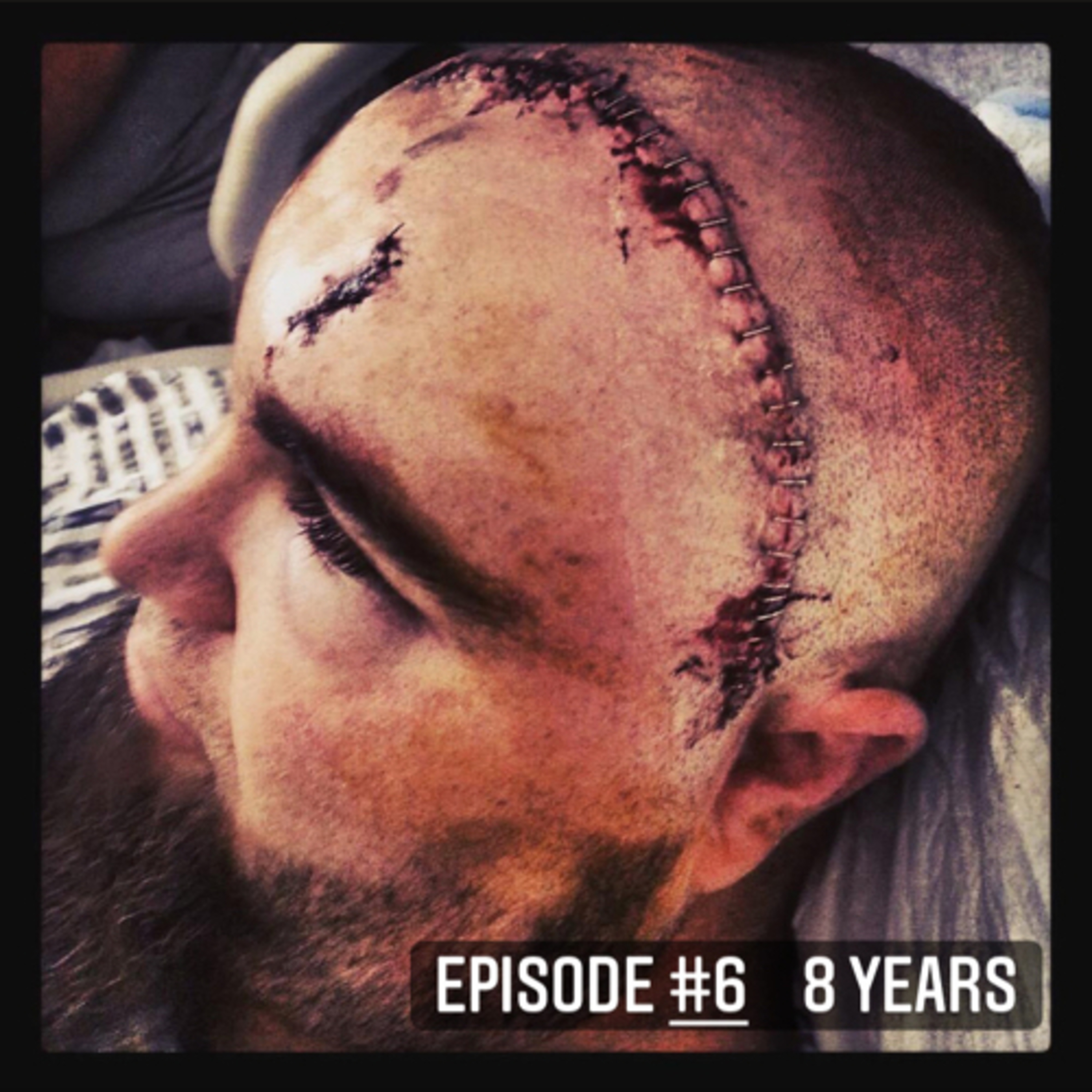 8 Years episode artwork