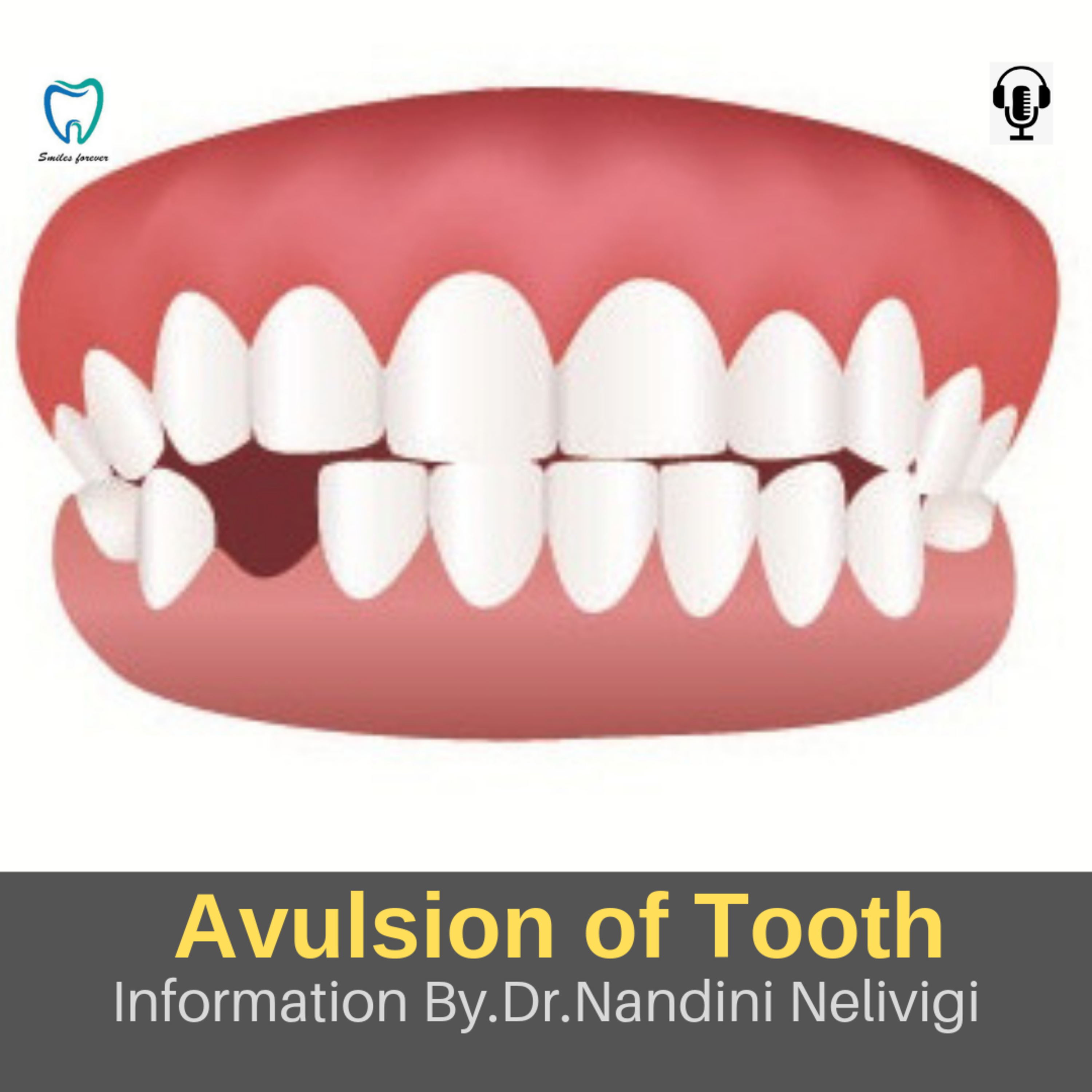 Dental Care Information By Dr. Nandini Nelivigi