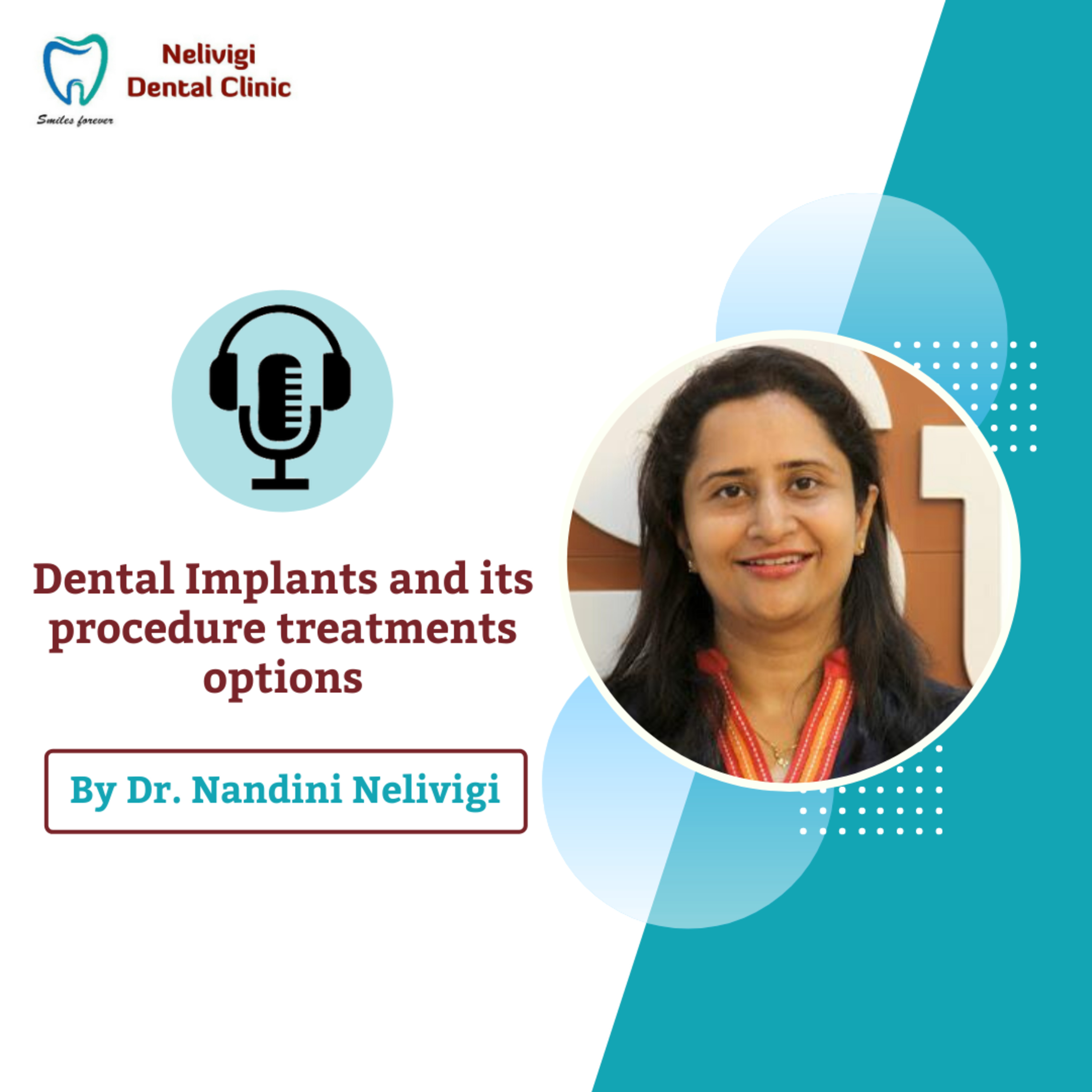 Dental Implants and its procedure treatments options By Dr. Nandini Nelivigi - Best Implantologist in Bellandur, Bangalore
