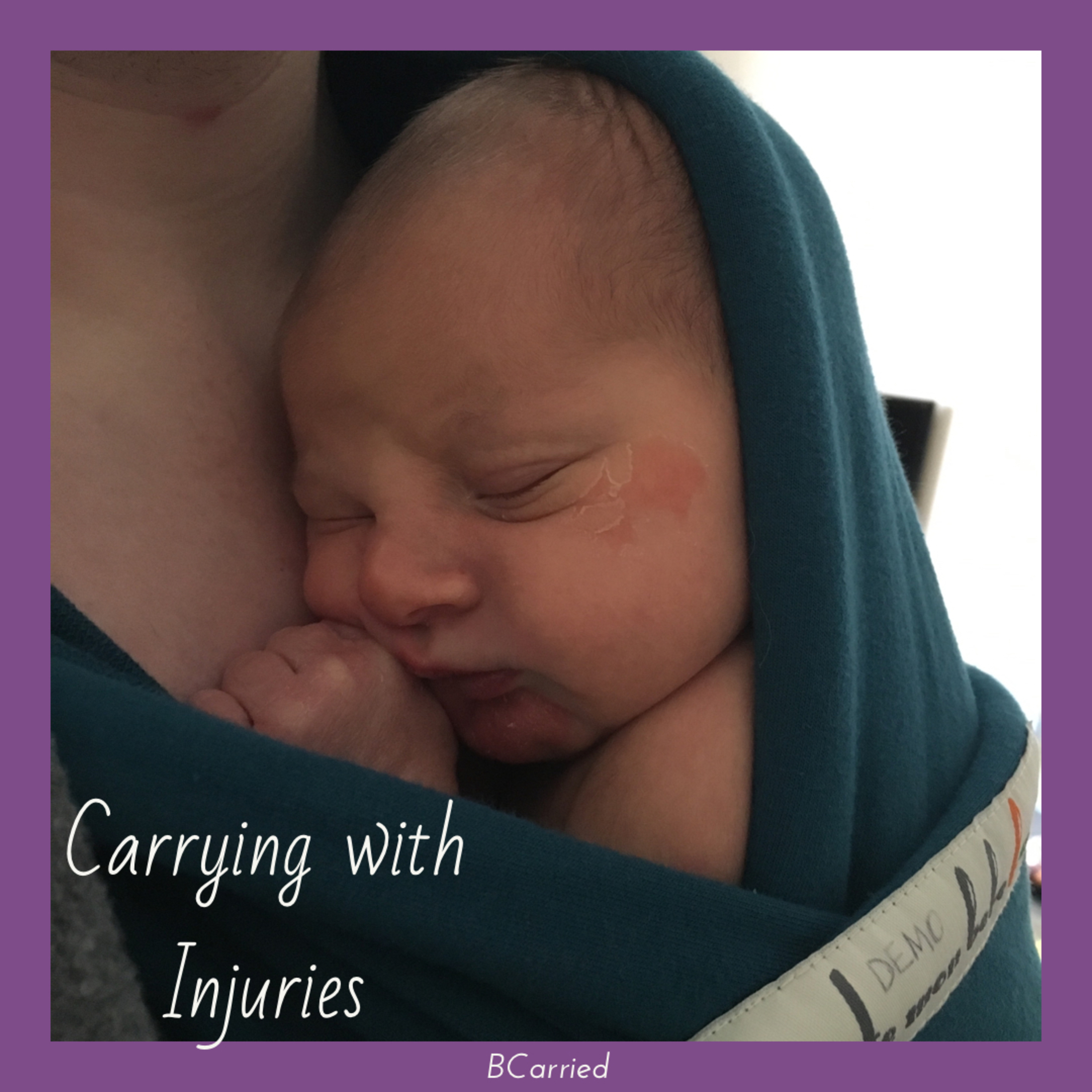 Carrying in a sling with injuries episode artwork