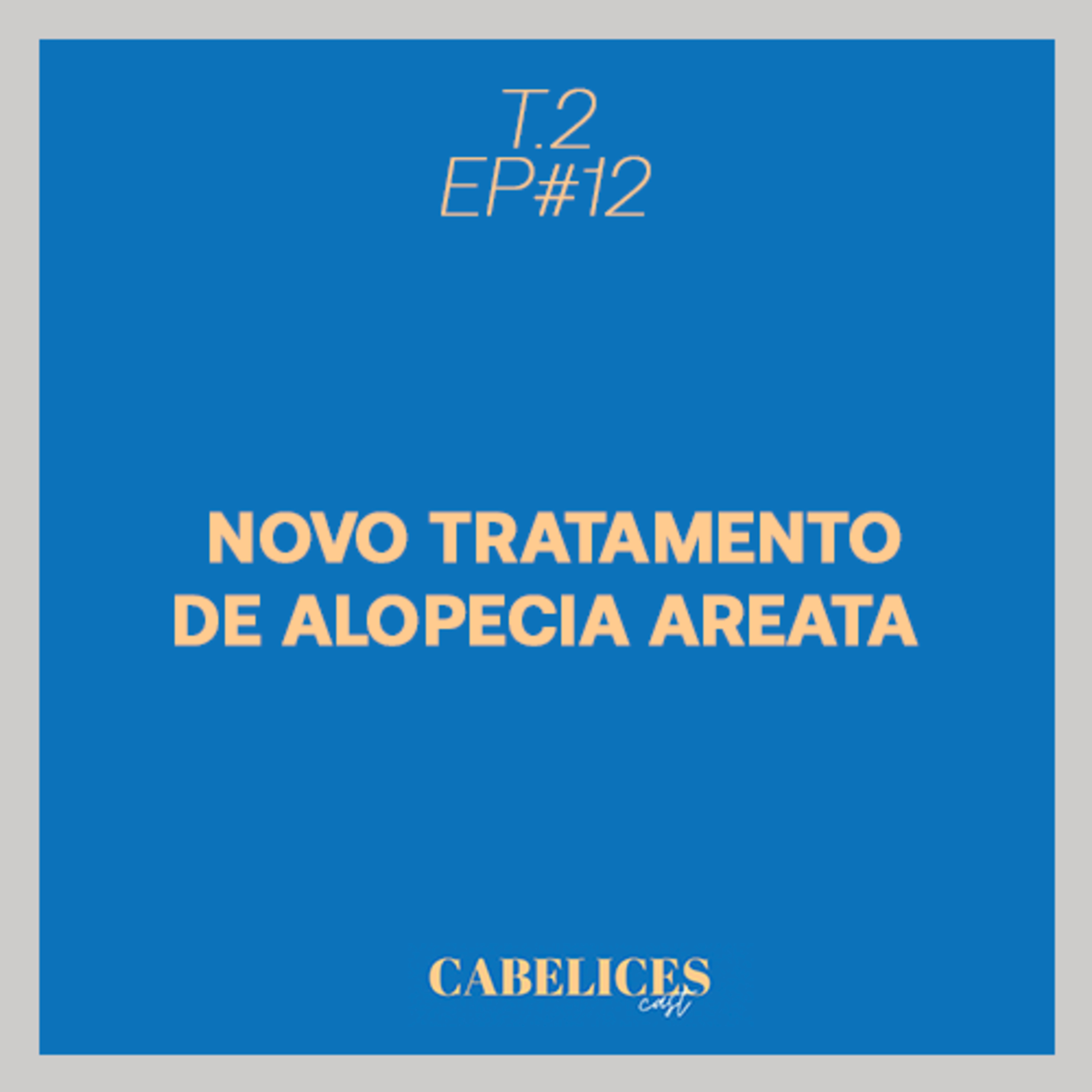 Cabelices Cast
