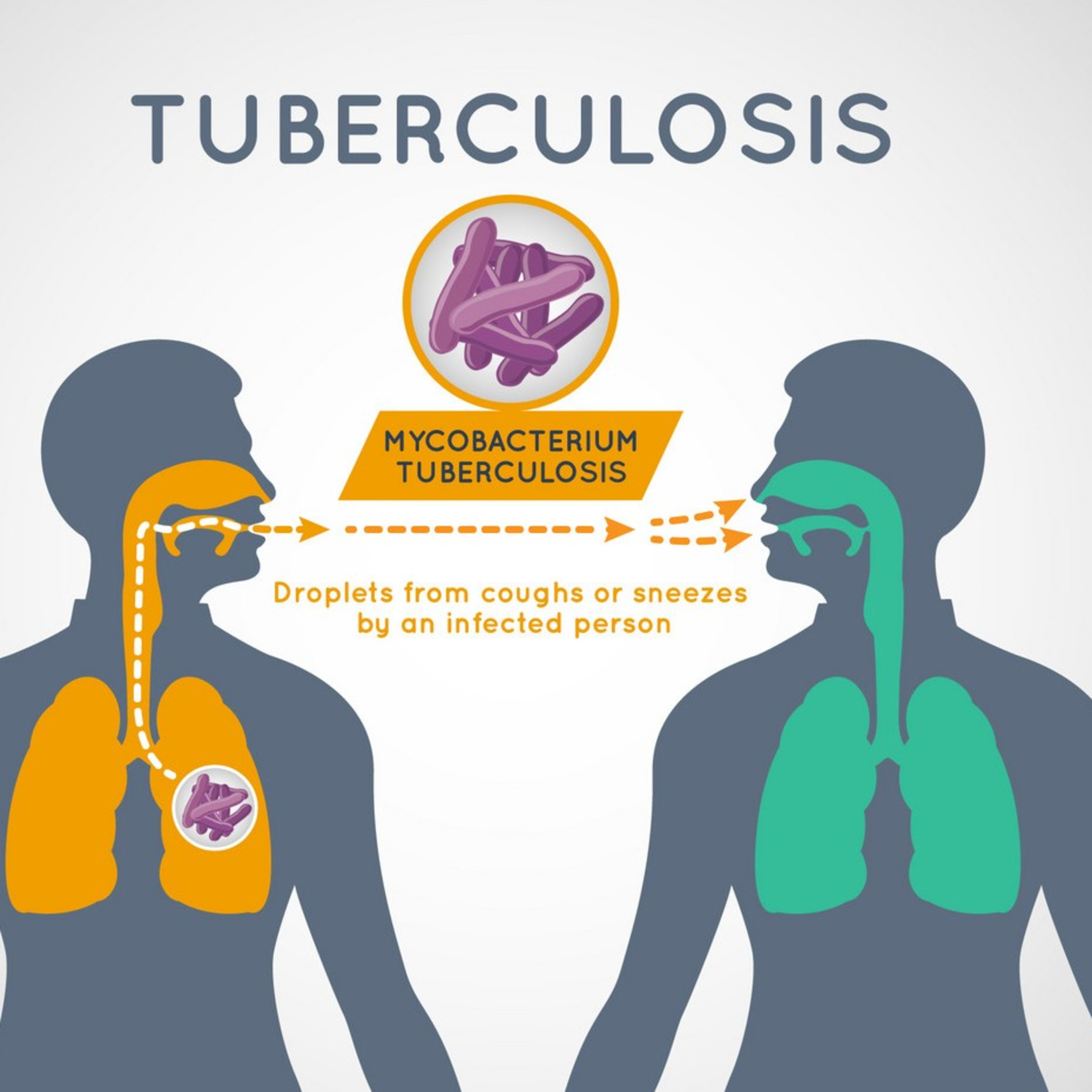 Awareness Space on TB disease by Dr Vinoth  episode artwork