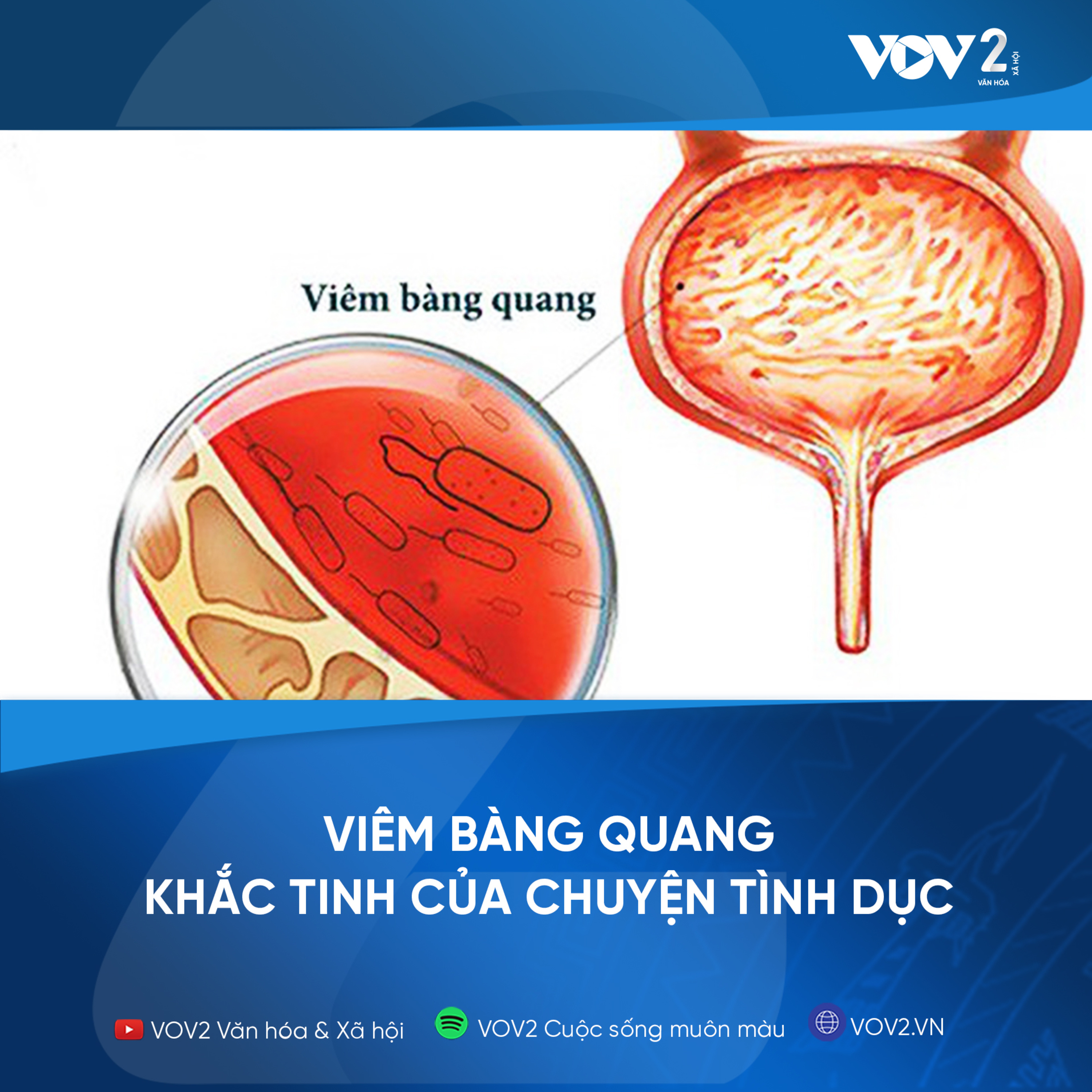 VOV2 Chuyện thầm kín