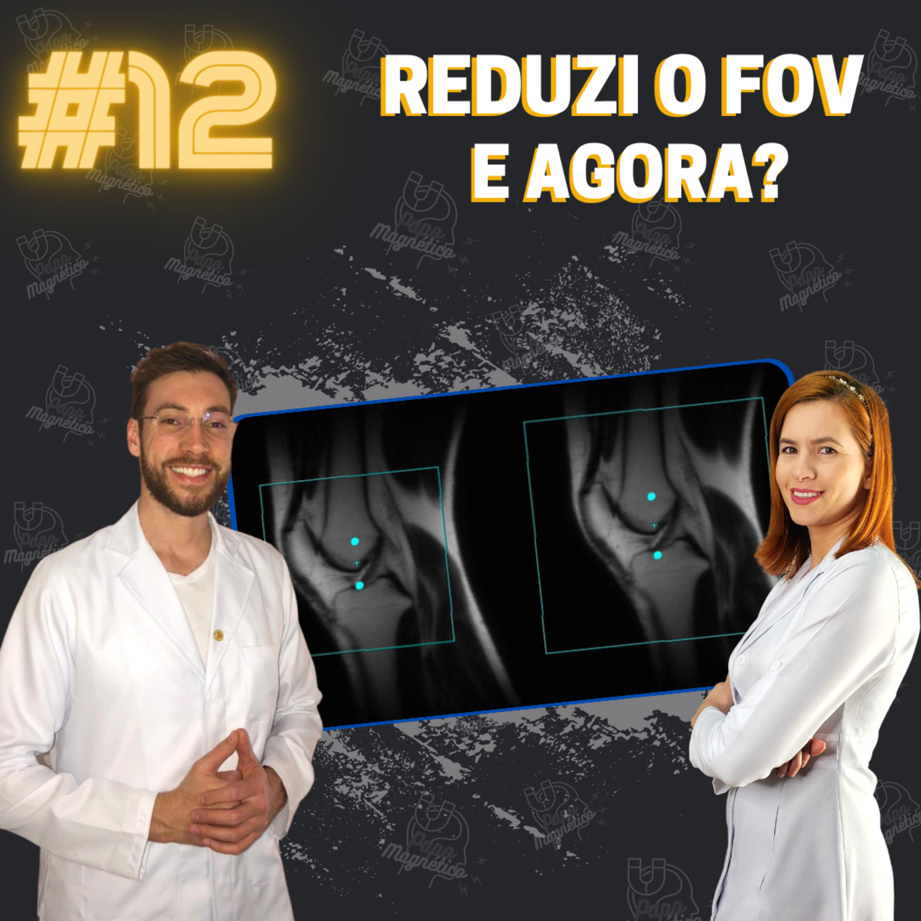 Papo Magnético #12 - REDUZI O FOV, E AGORA? episode artwork