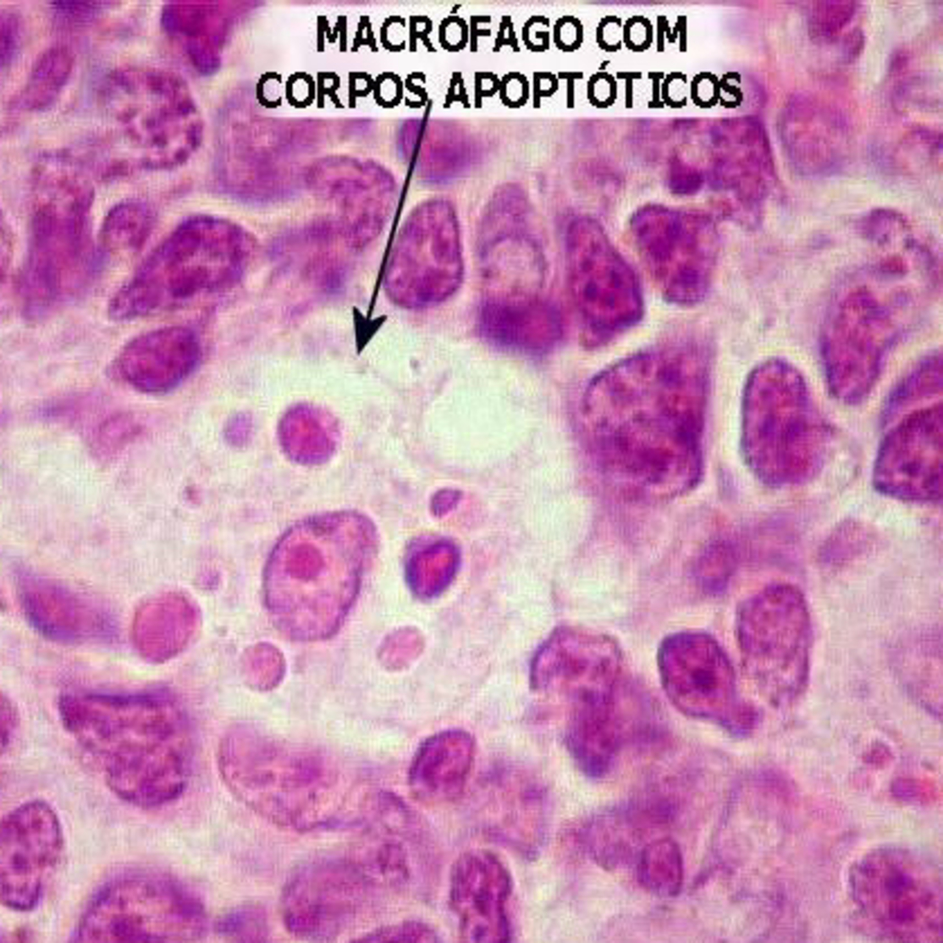 Simples Medicina, uma aluna do P4 (UNIPE) que quer acreditar que será simples
