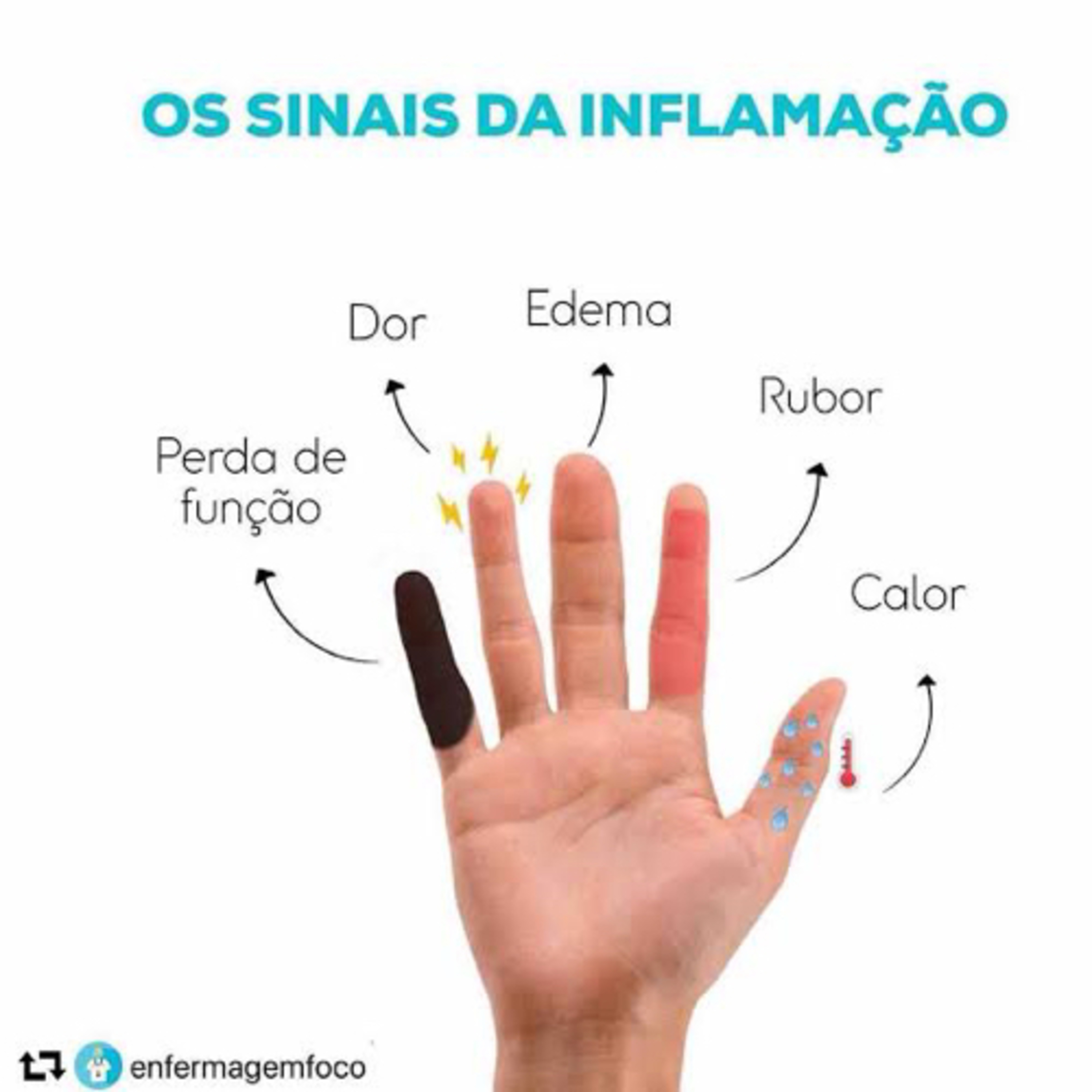 Simples Medicina, uma aluna do P4 (UNIPE) que quer acreditar que será simples