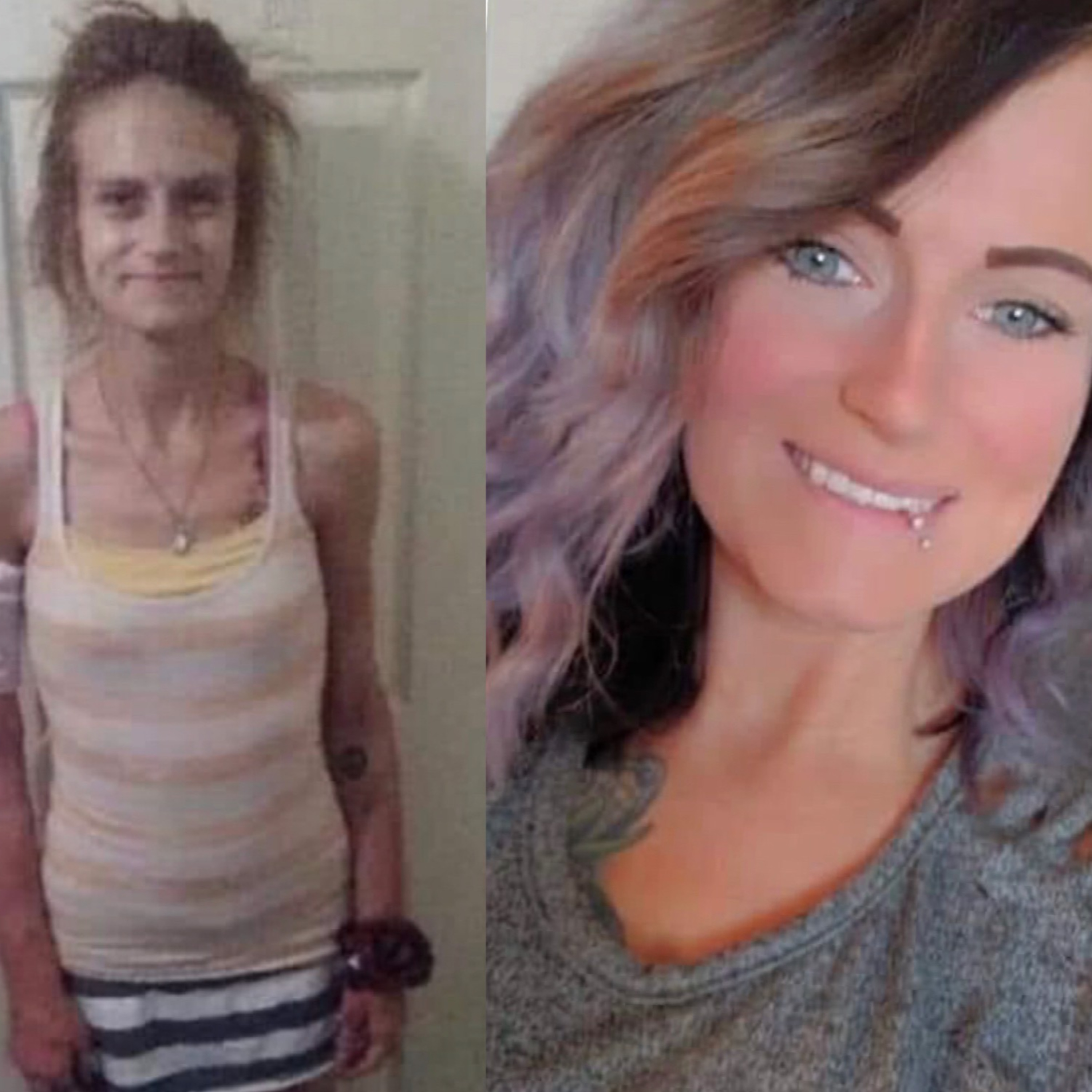 The Clip With Nicoles Shocking Before & After! episode artwork