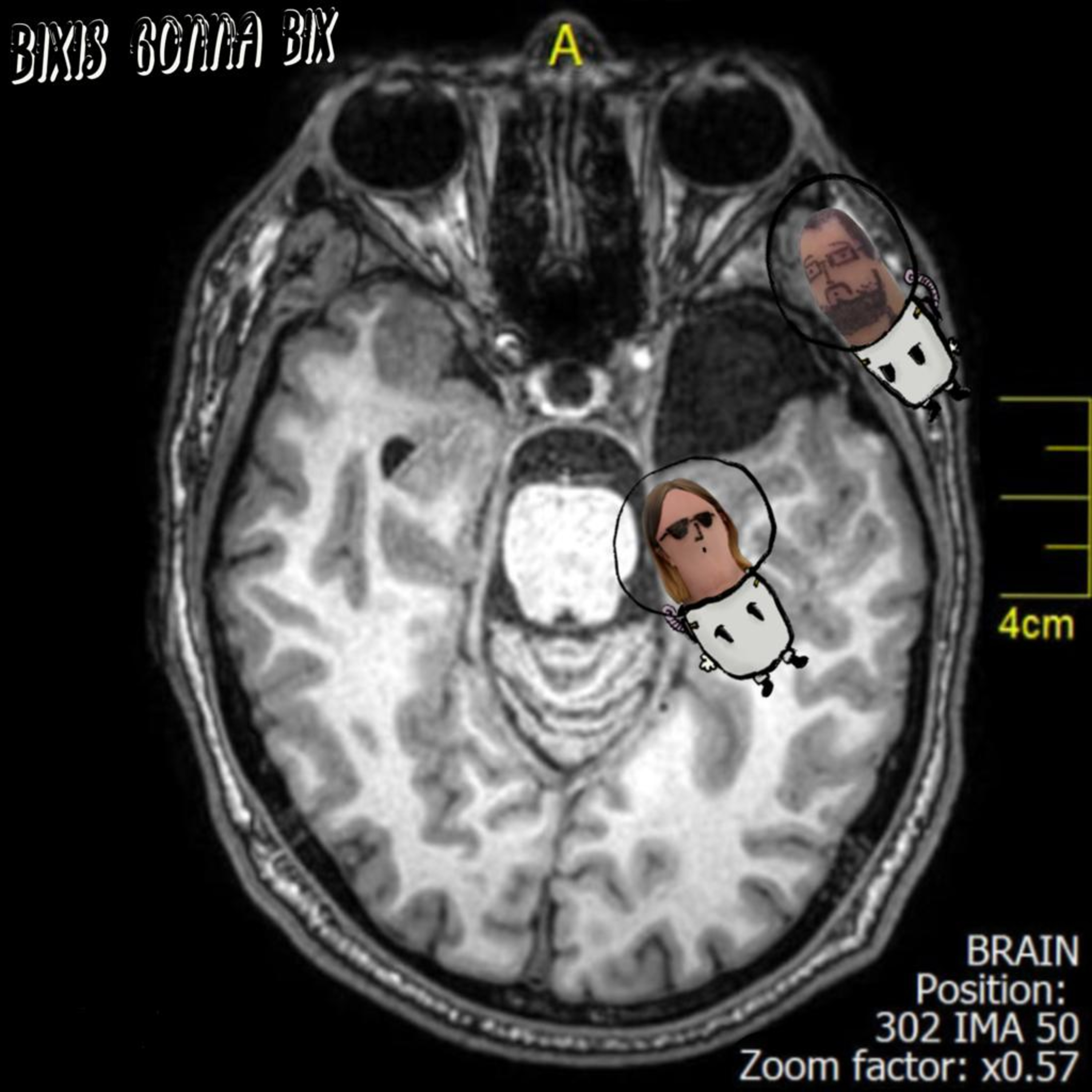 T01E02: Mamá, me falta un pedazo de cerebro