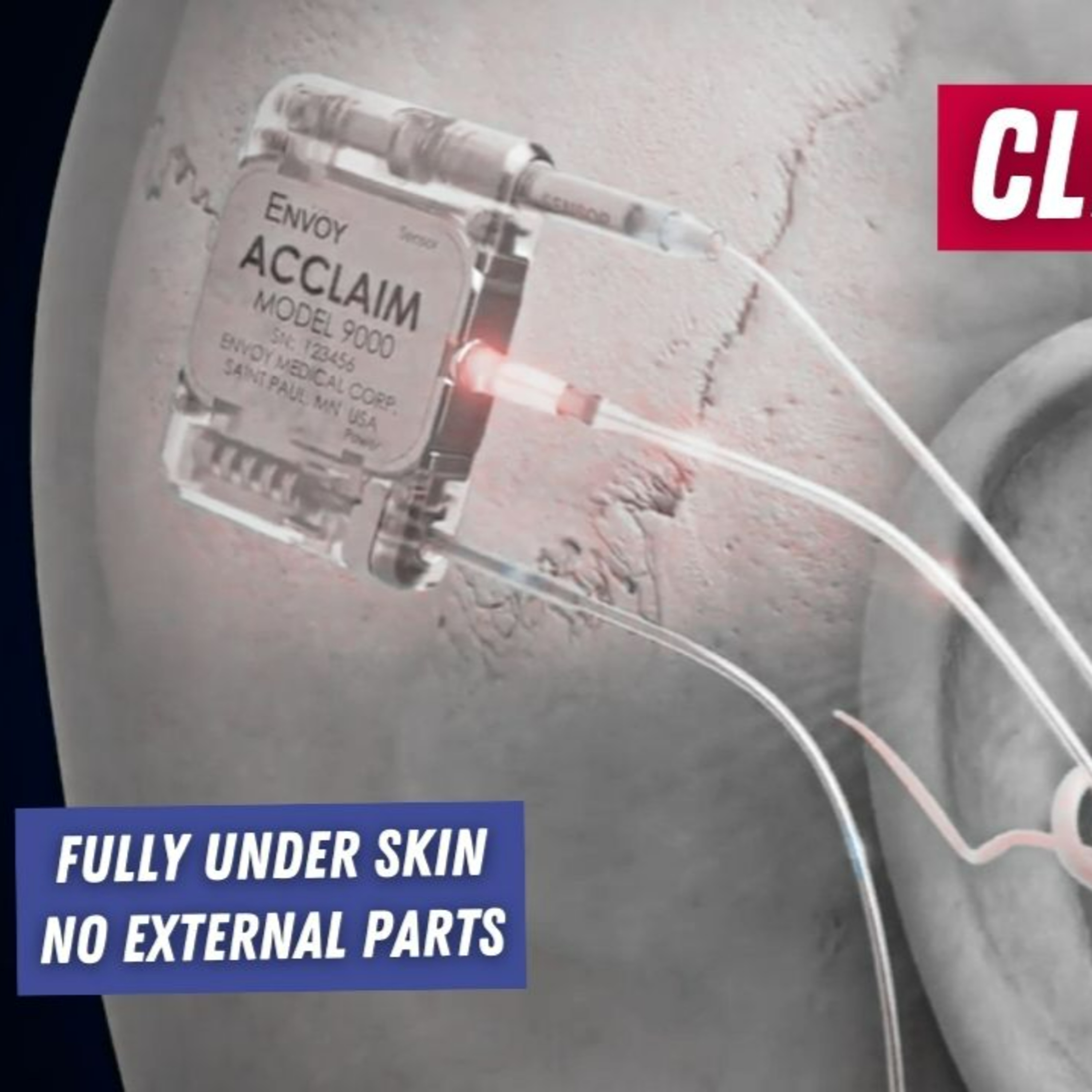 This Week in Hearing