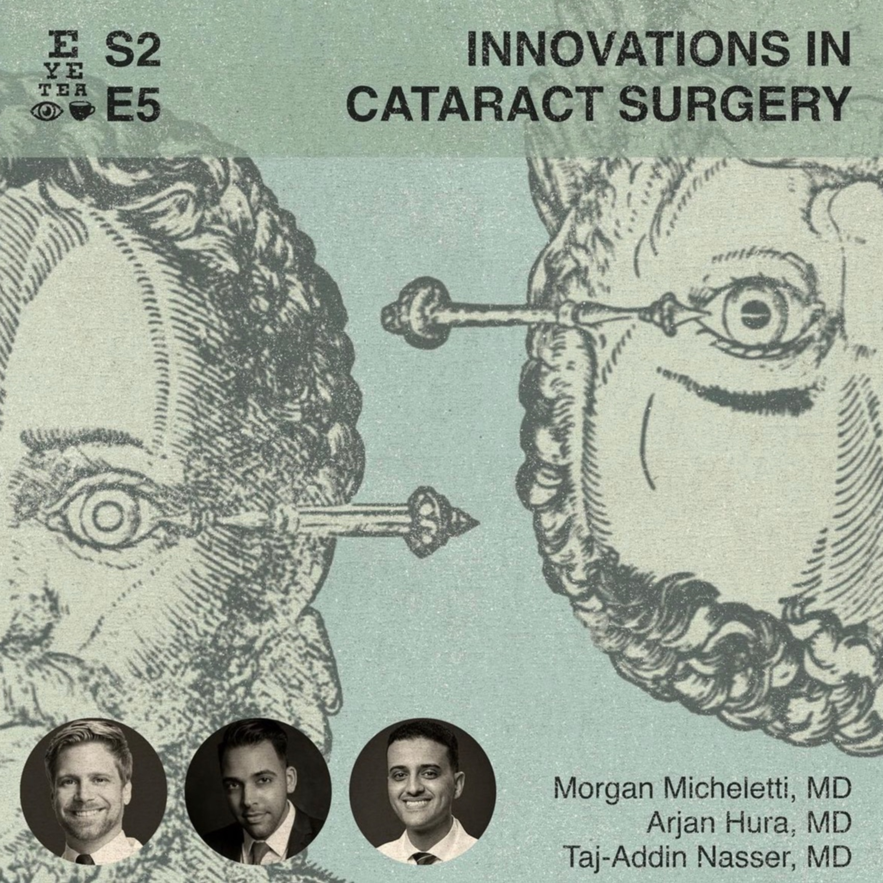 S2:E5 - Eye Tea - Innovations in Refractive Cataract Surgery - Drs. Morgan Micheletti, Arjan Hura, and Taj Nasser.
