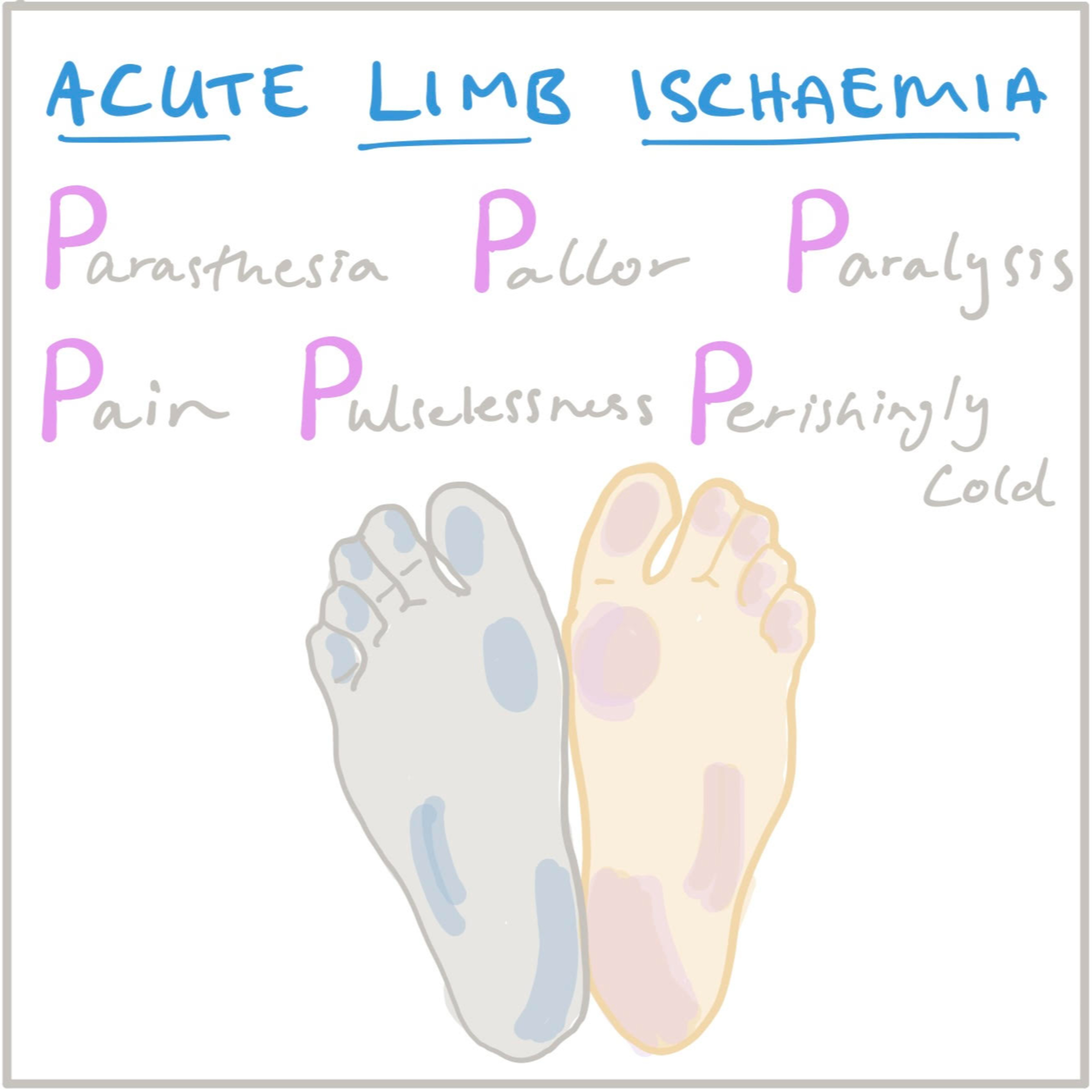 Acute Limb Ischaemia episode artwork
