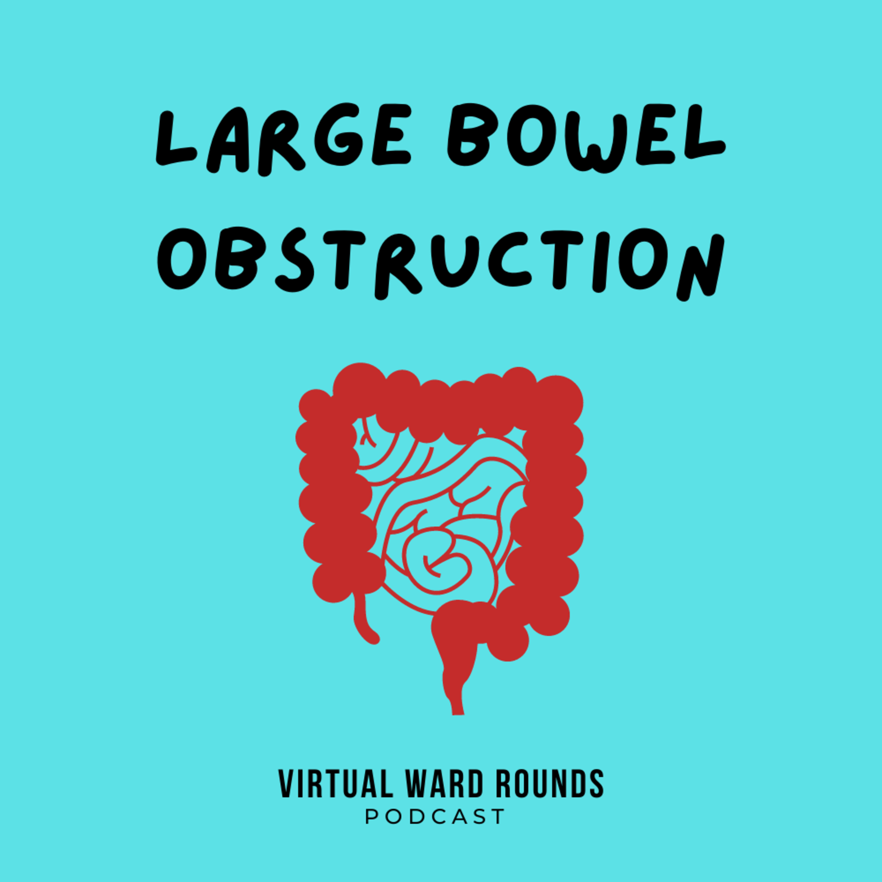 Large Bowel Obstruction
