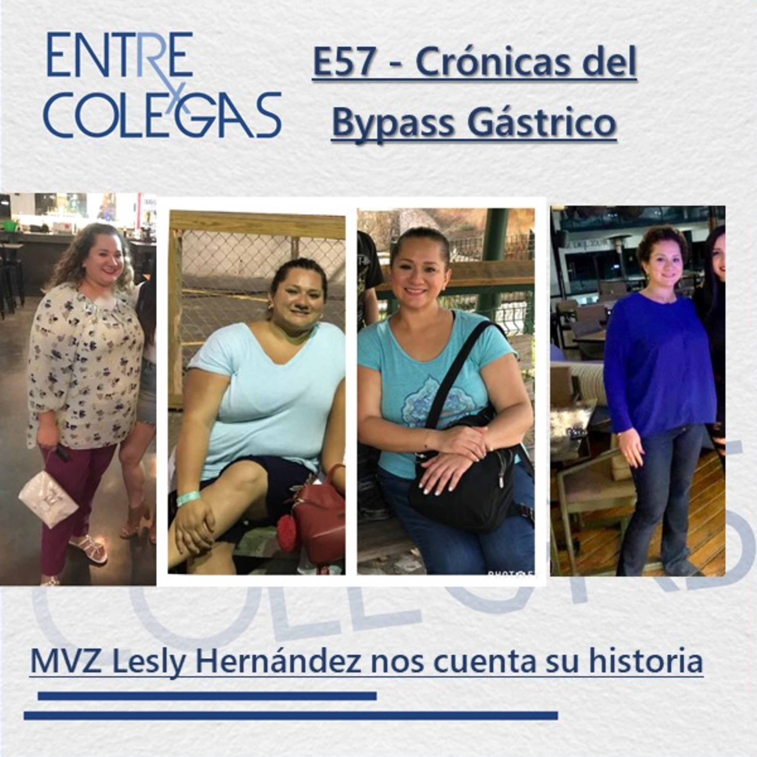 E57 - Crónicas del Bypass Gástrico episode artwork