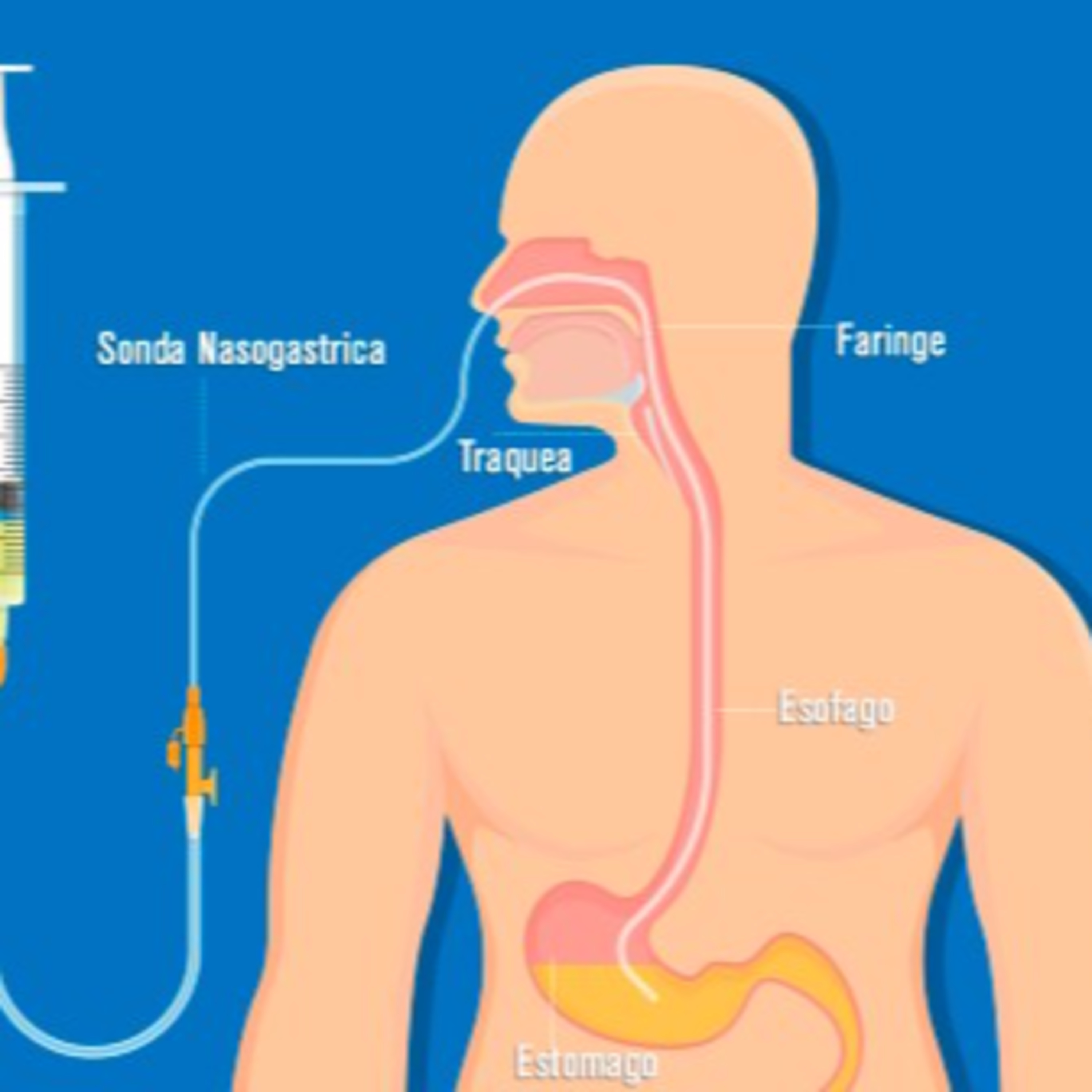 Nutrición Enteral episode artwork