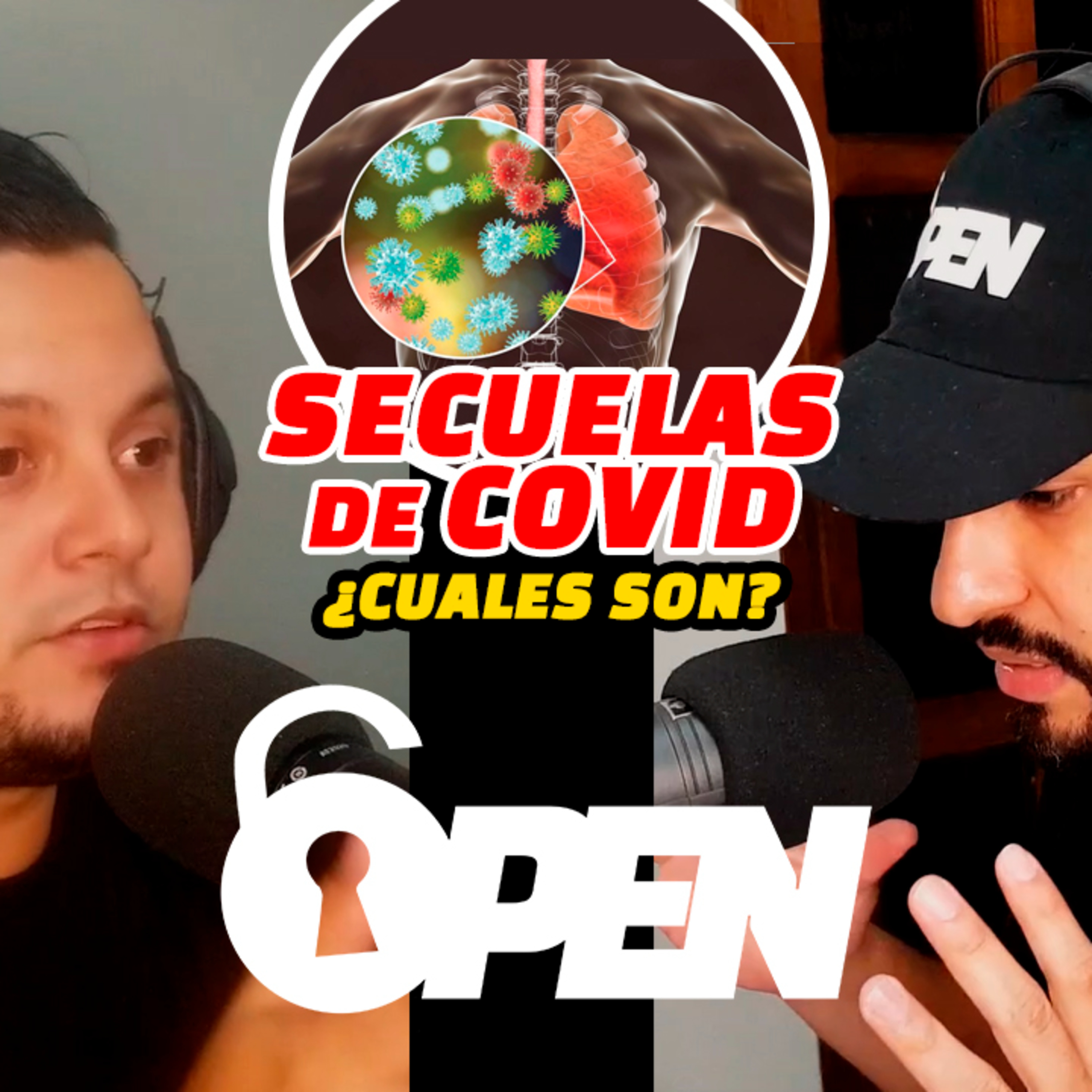 OPEN Podcast