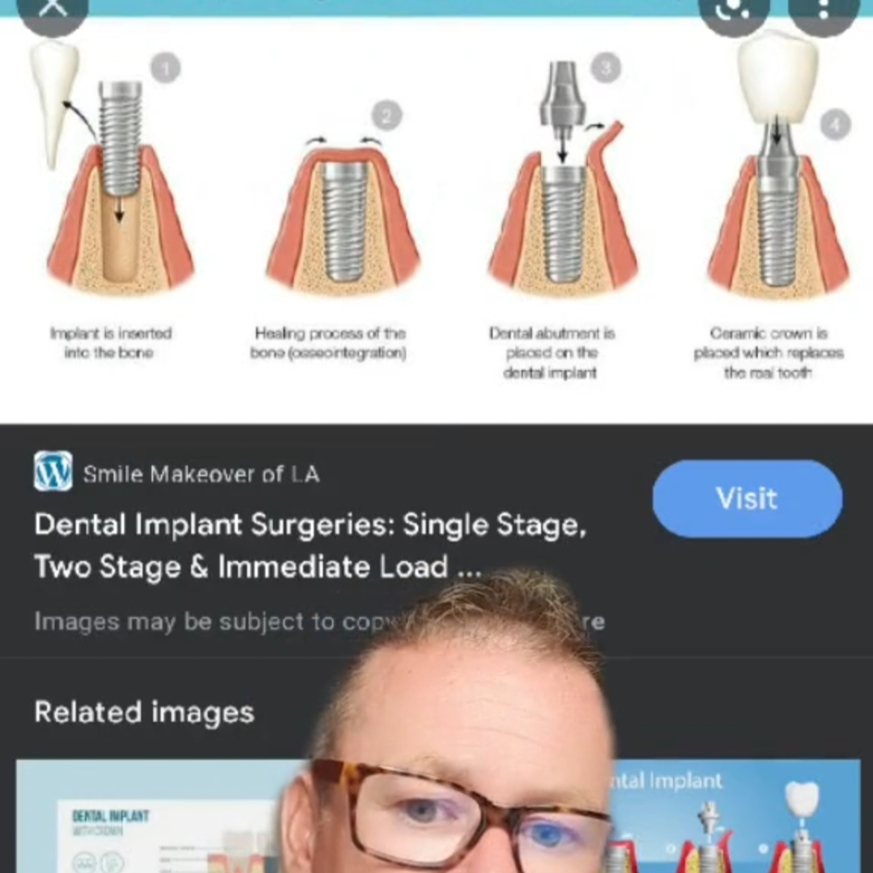 Dental Departures