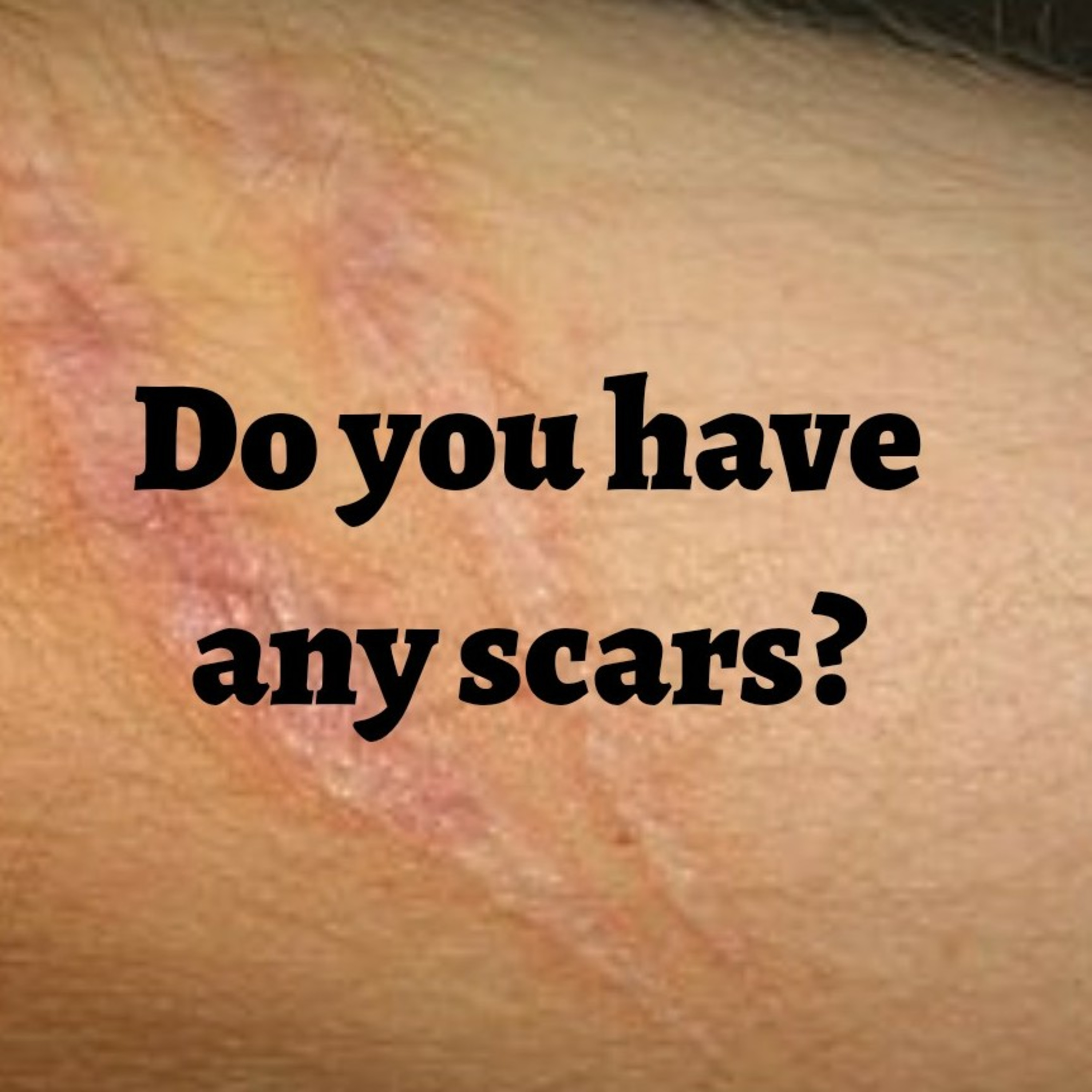 Do you have any scars? episode artwork
