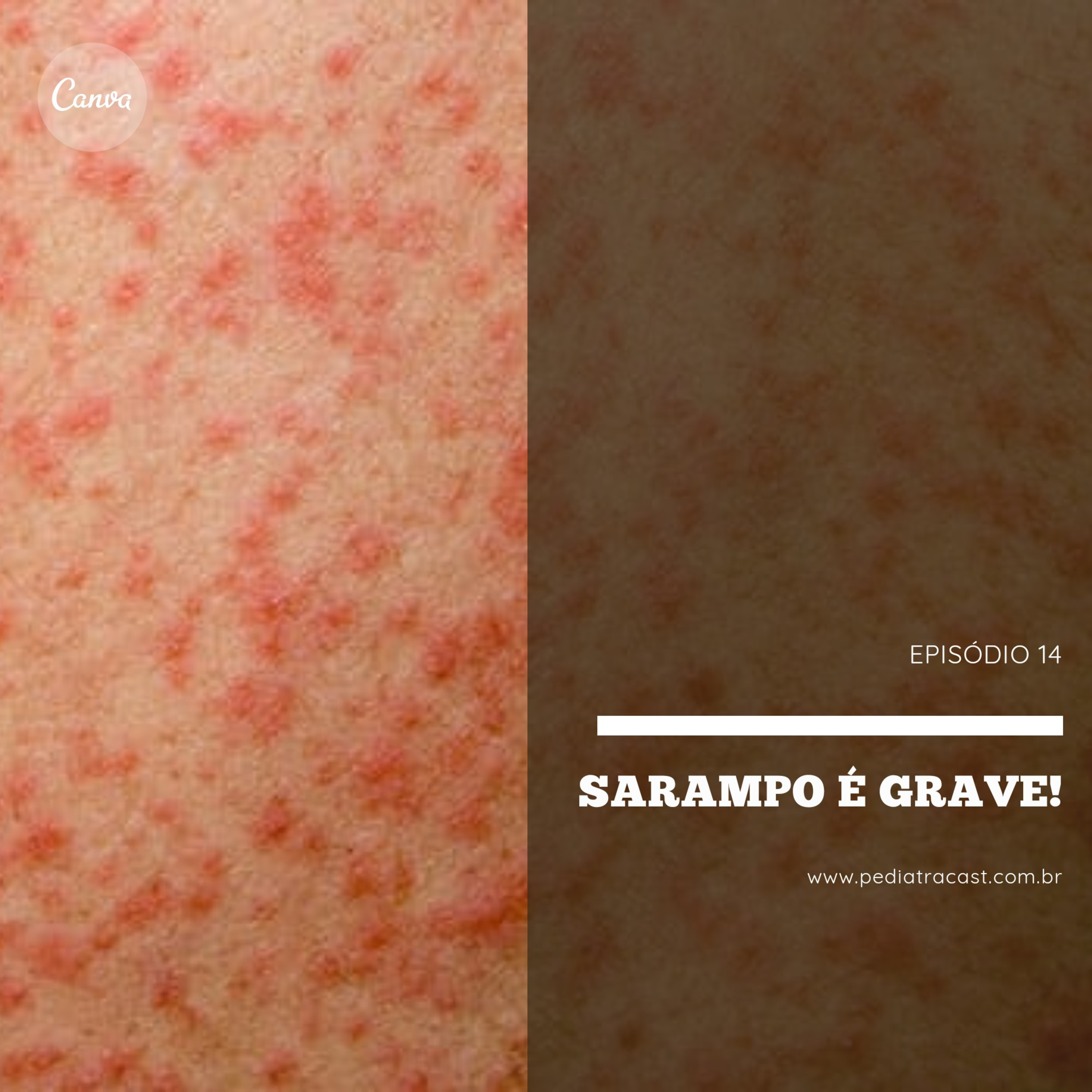 Pediatracast - Pediatria & Filhos