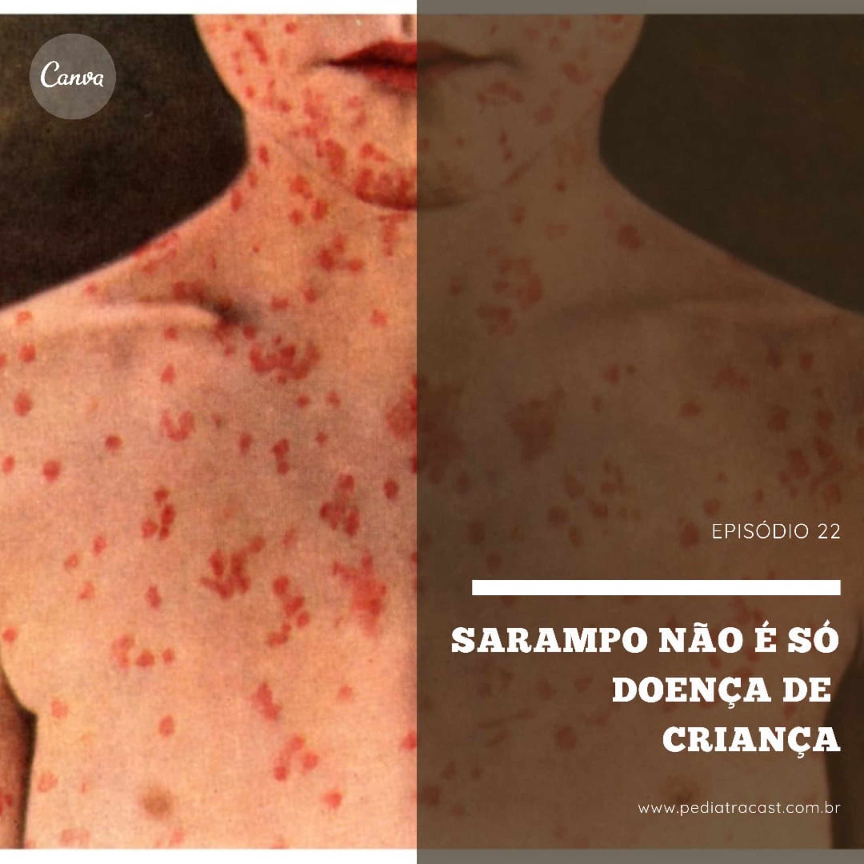 Pediatracast - Pediatria & Filhos