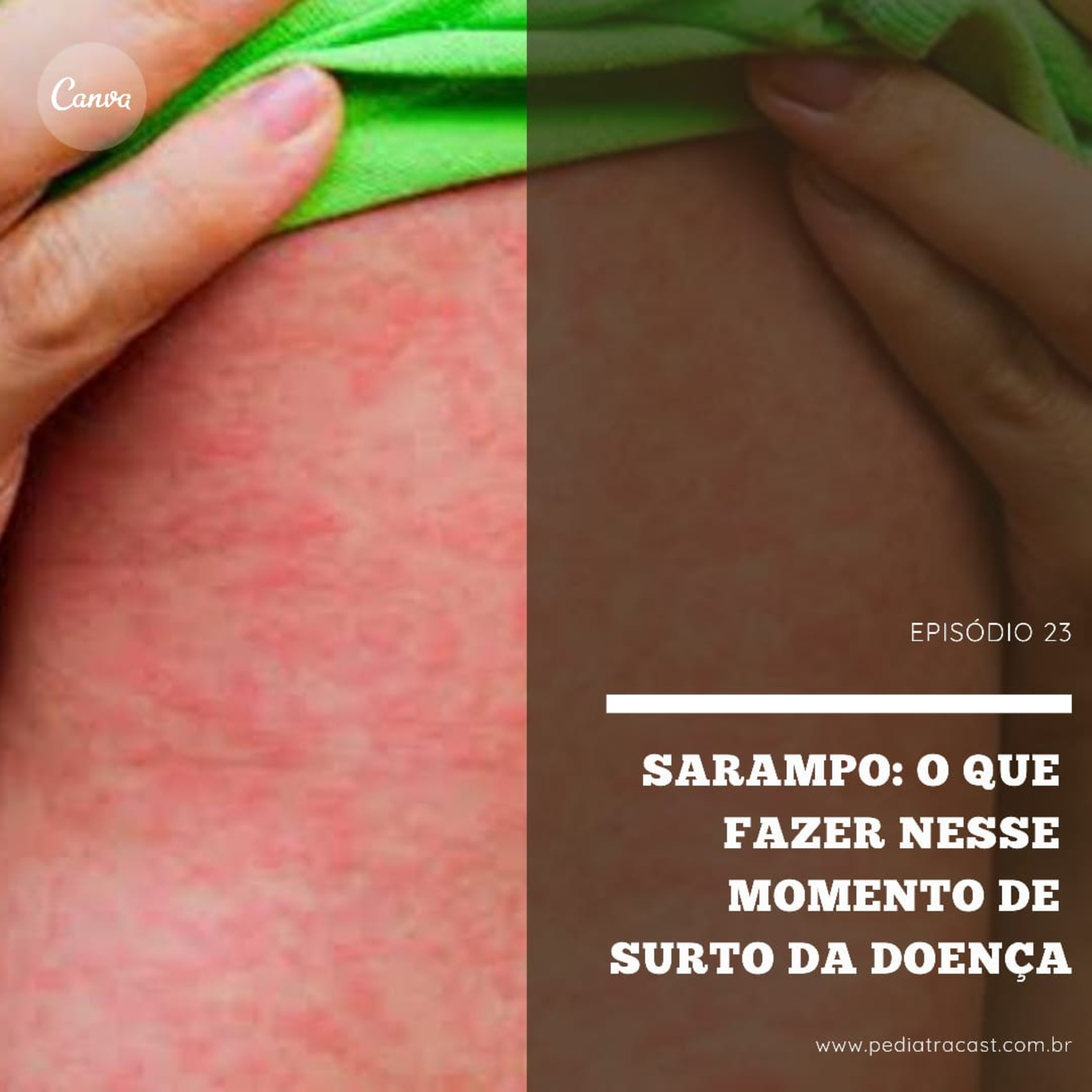 Pediatracast - Pediatria & Filhos