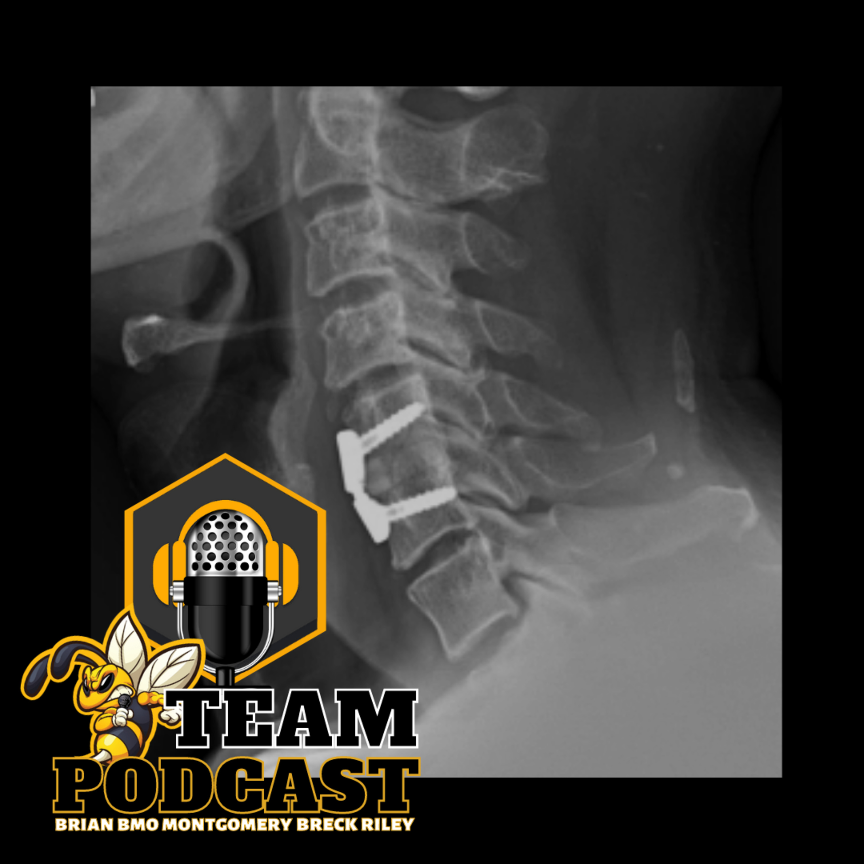 The B-Team Podcast