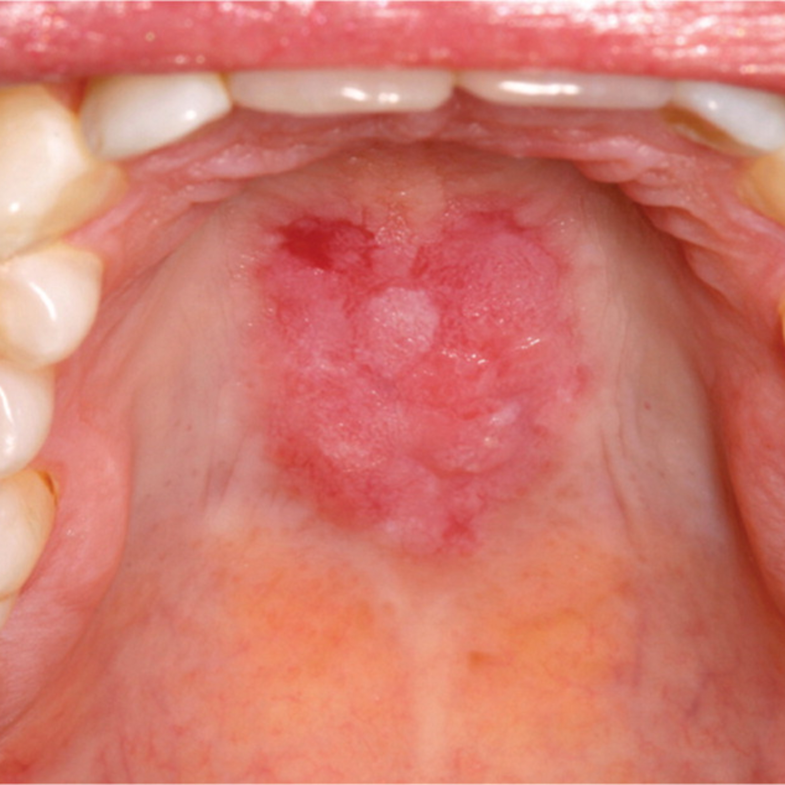 Fundamento del diagnóstico oral en odontología episode artwork