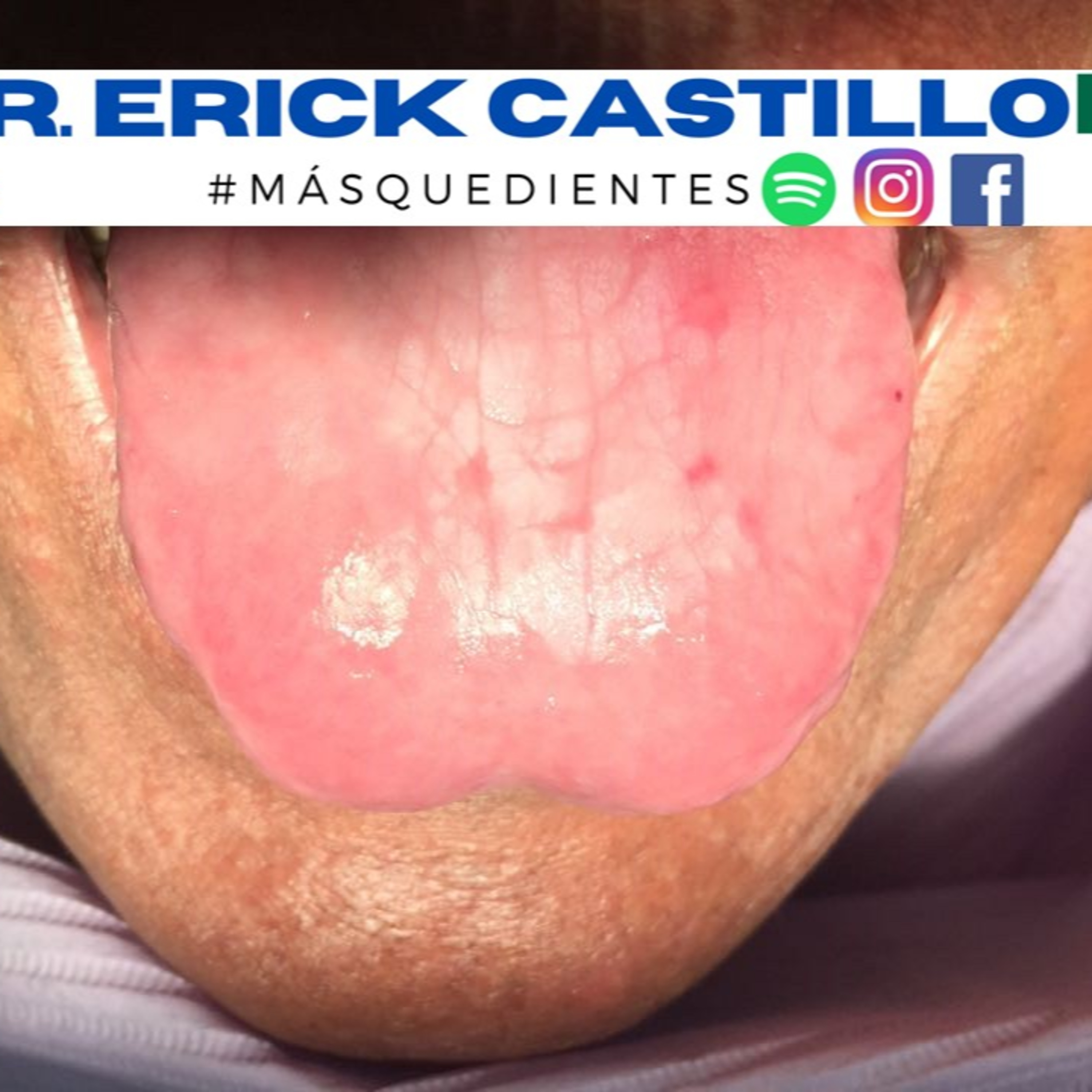 ¿Te duele la lengua? Debes escuchar este podcast episode artwork