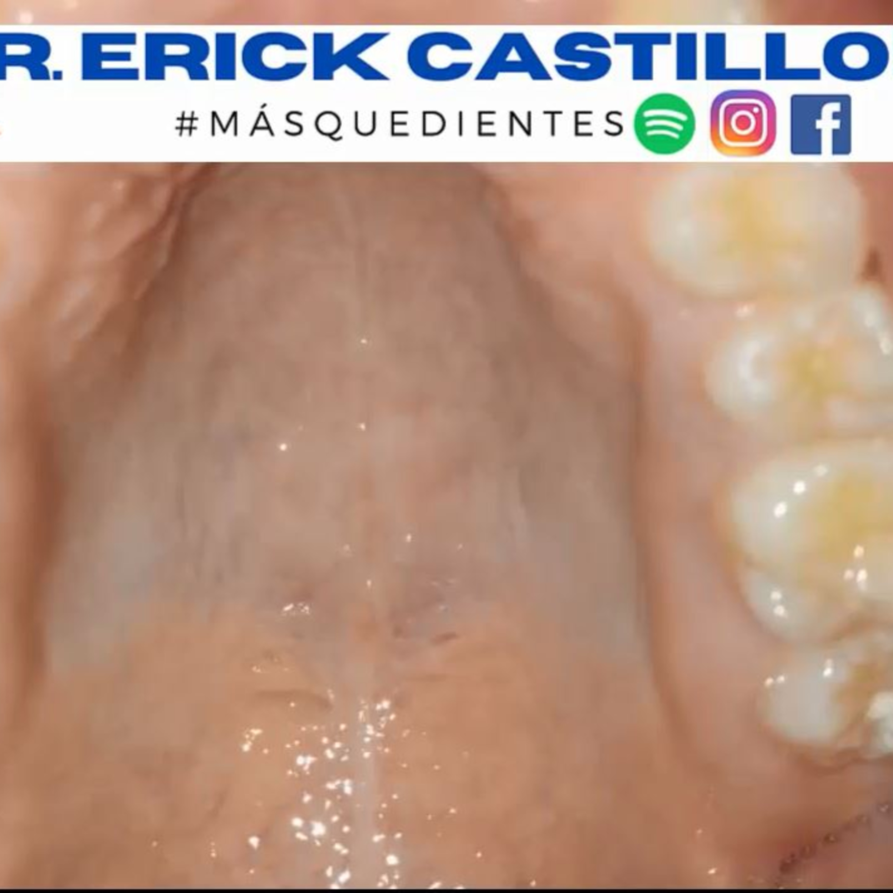Mas Que Dientes