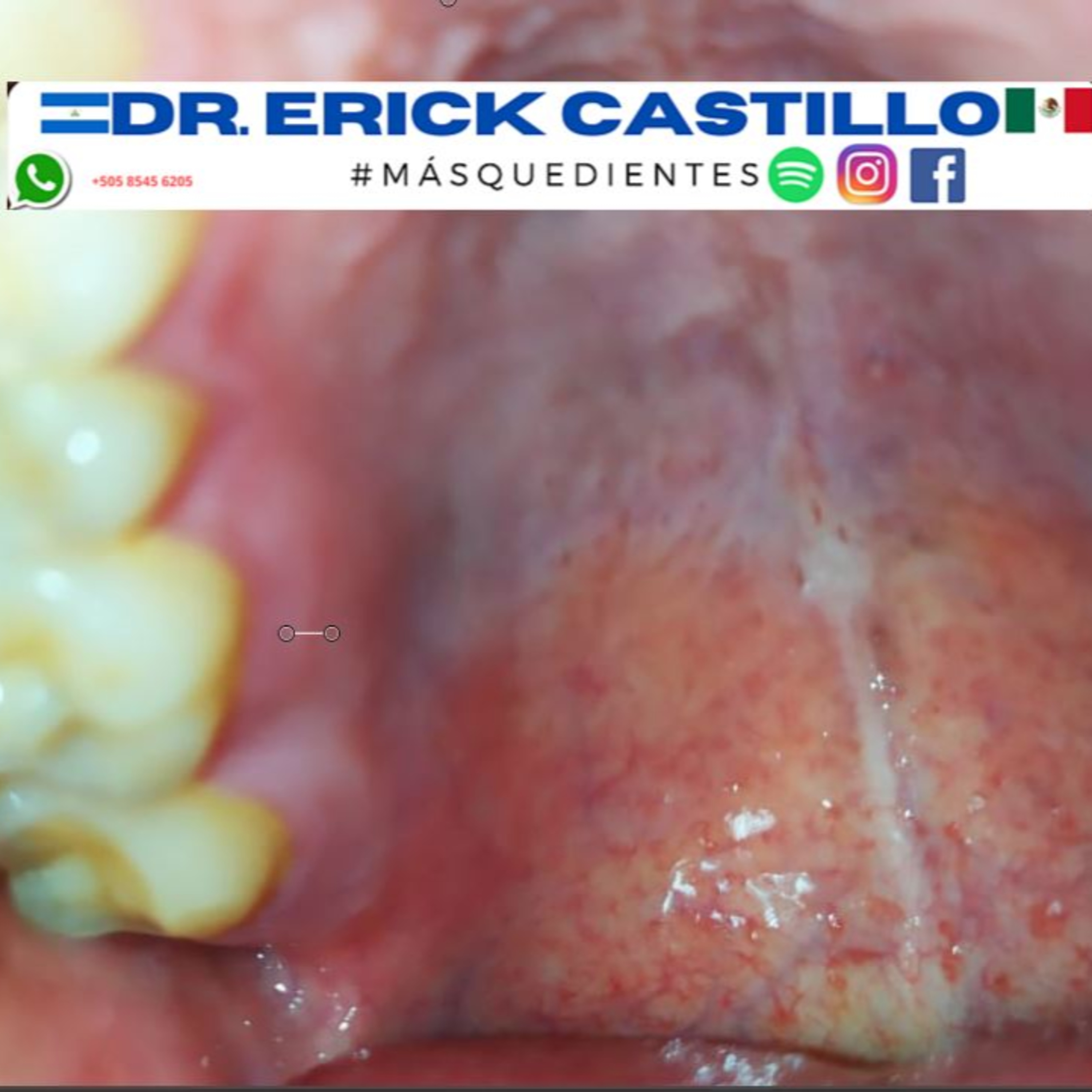 Mas Que Dientes