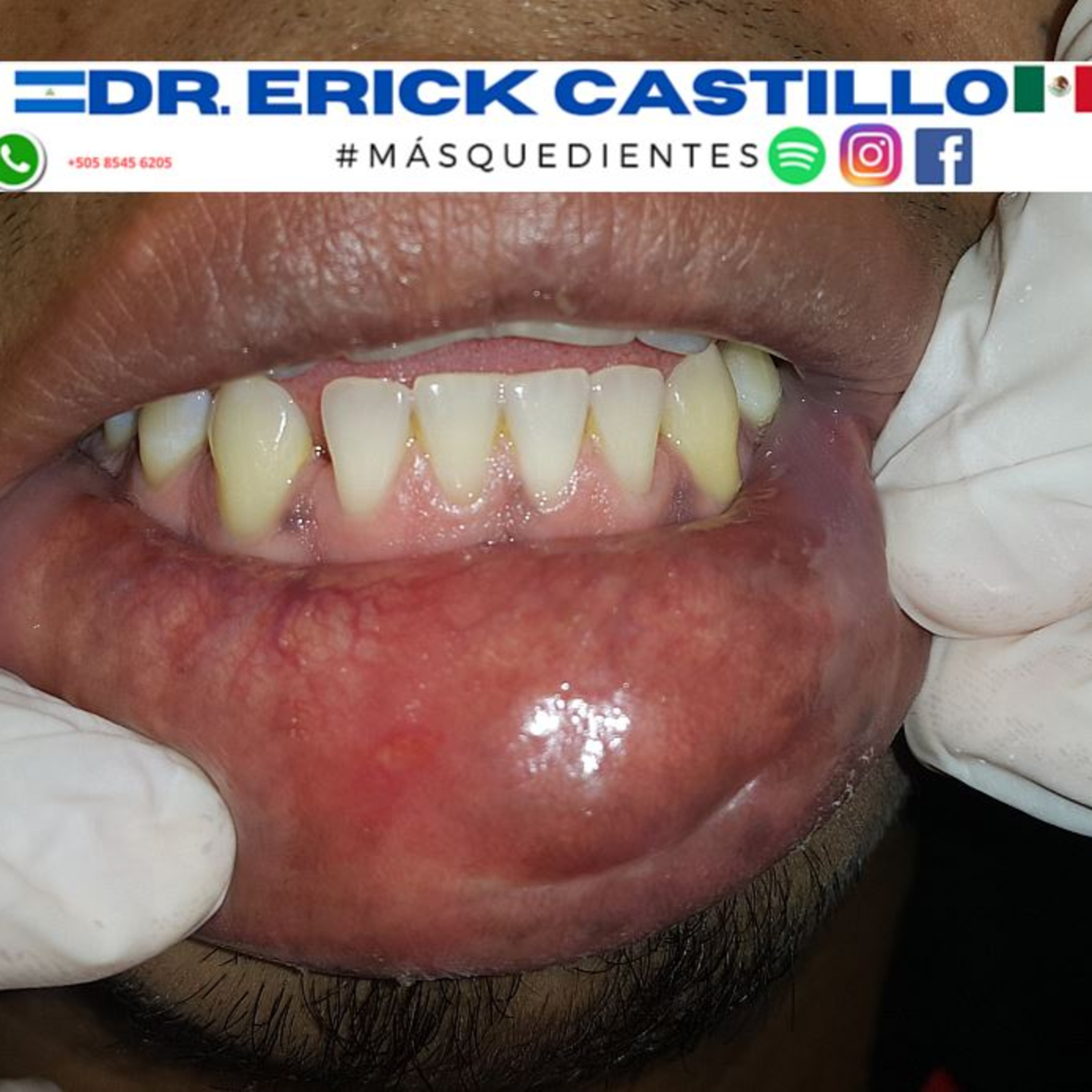 No dejes pasar por alto los cambios en los labios ¿Ya viste este labio? episode artwork