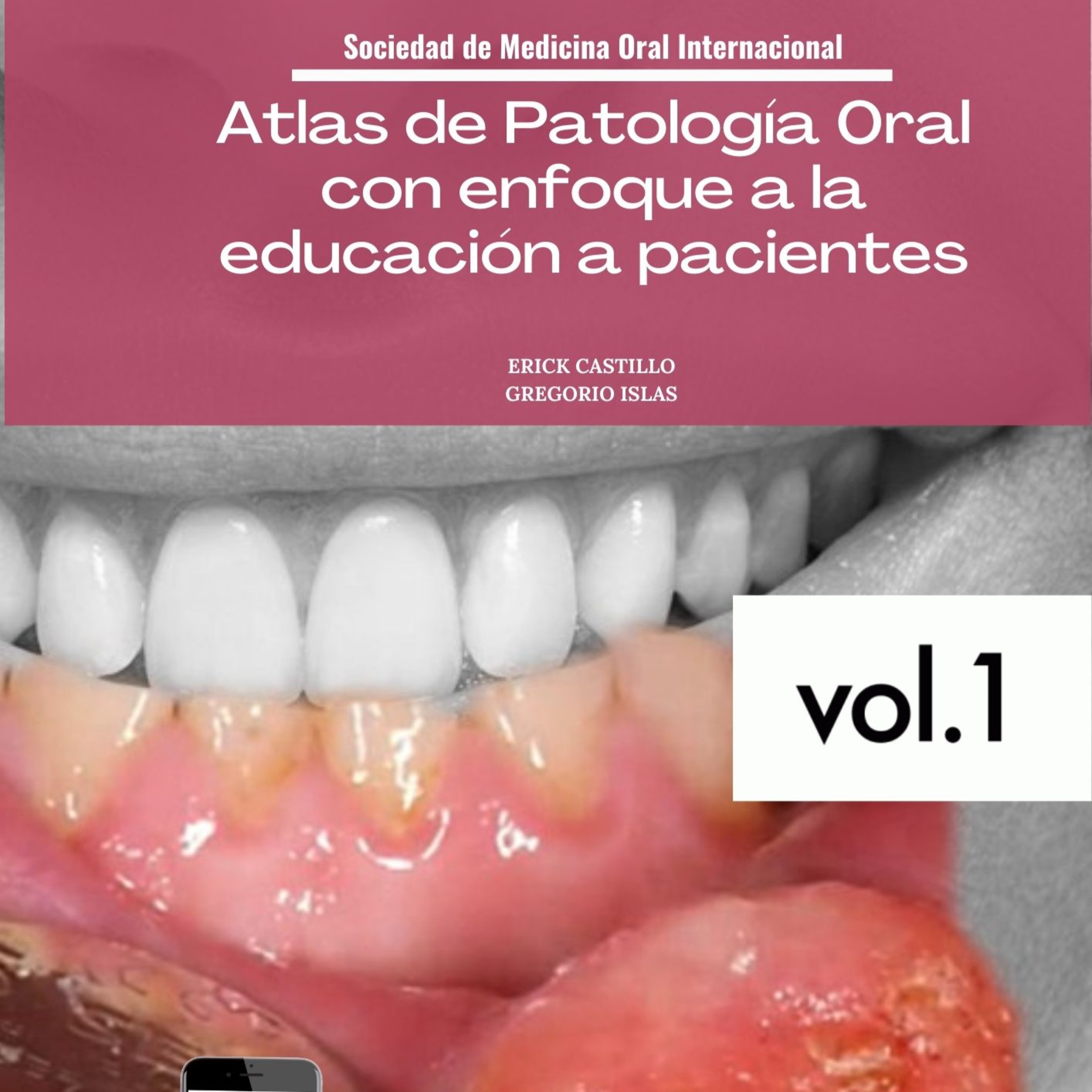 Ulceras de la cavidad oral episode artwork