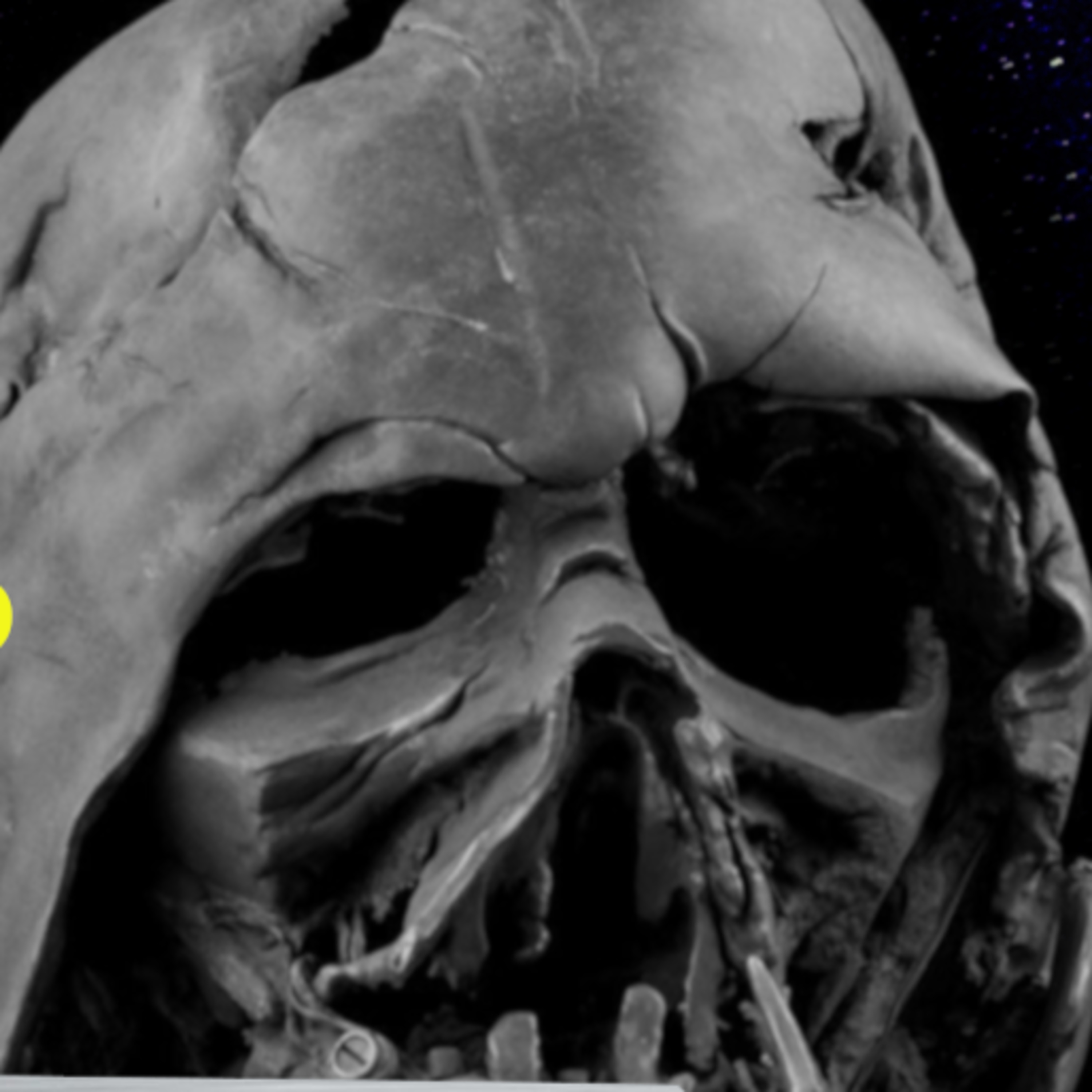 The Slow Sad Death of Star Wars? | Fulcrum Report 52 episode artwork