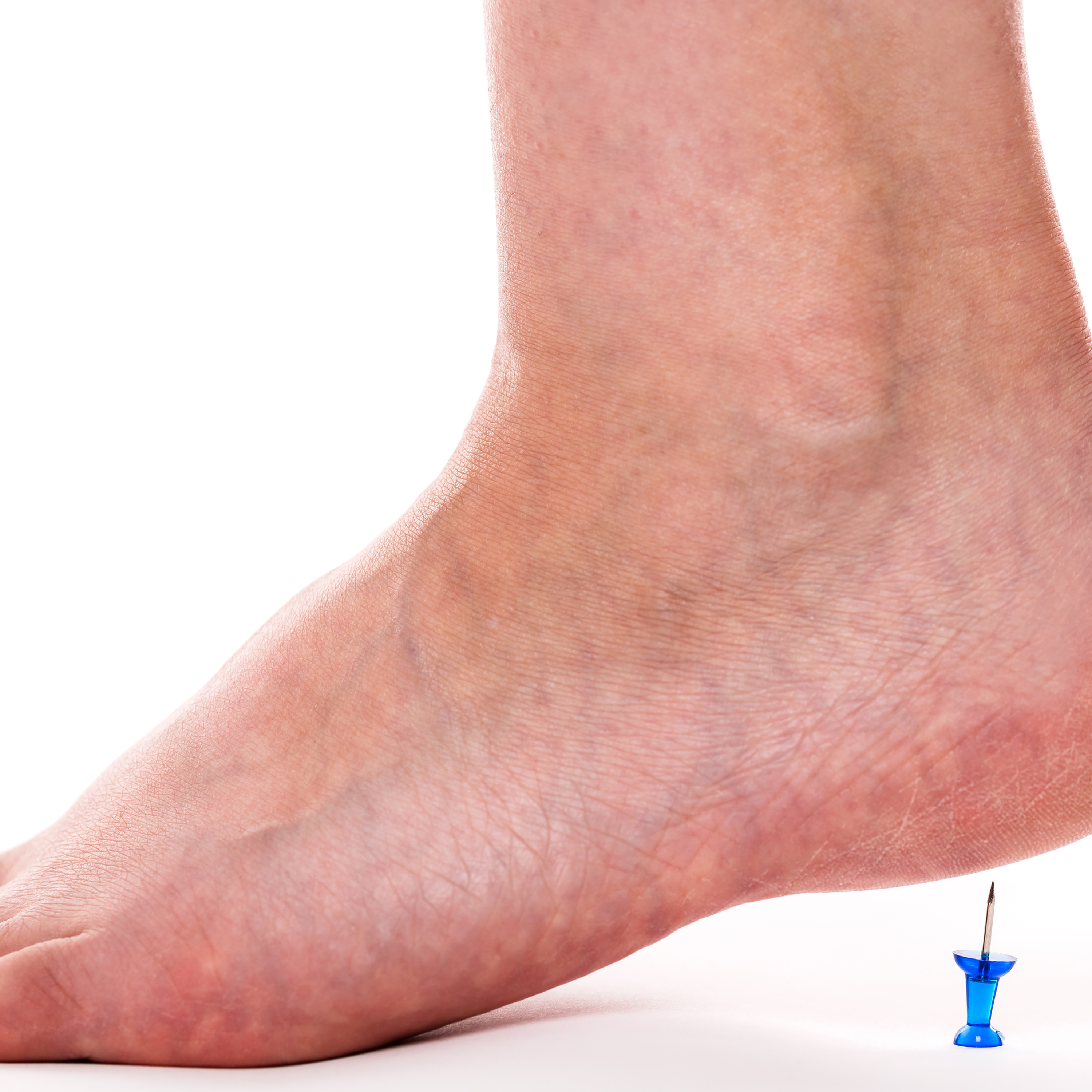 Episode 9 : Plantar Fasciitis