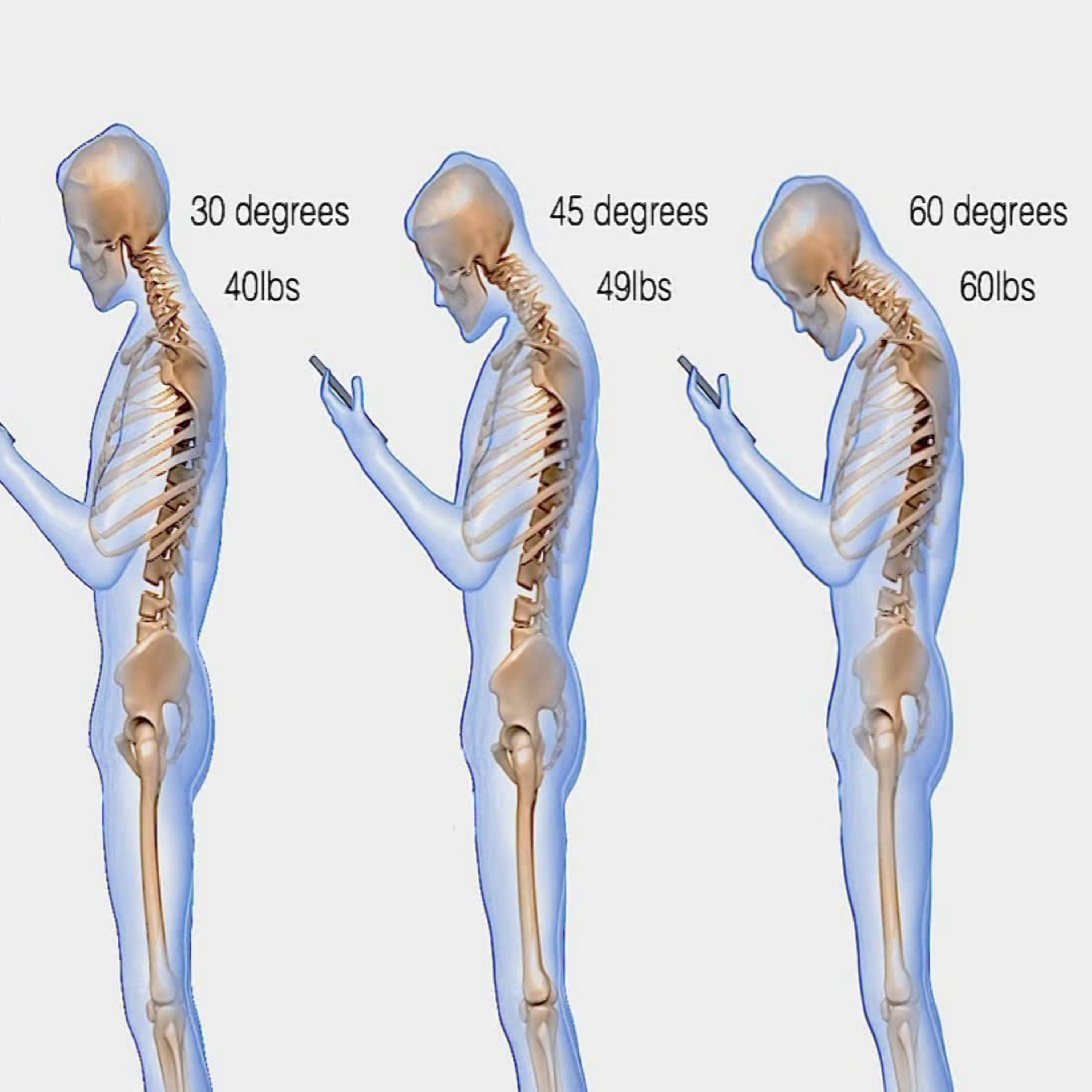 Episode 12 : Posture. Does it matter?