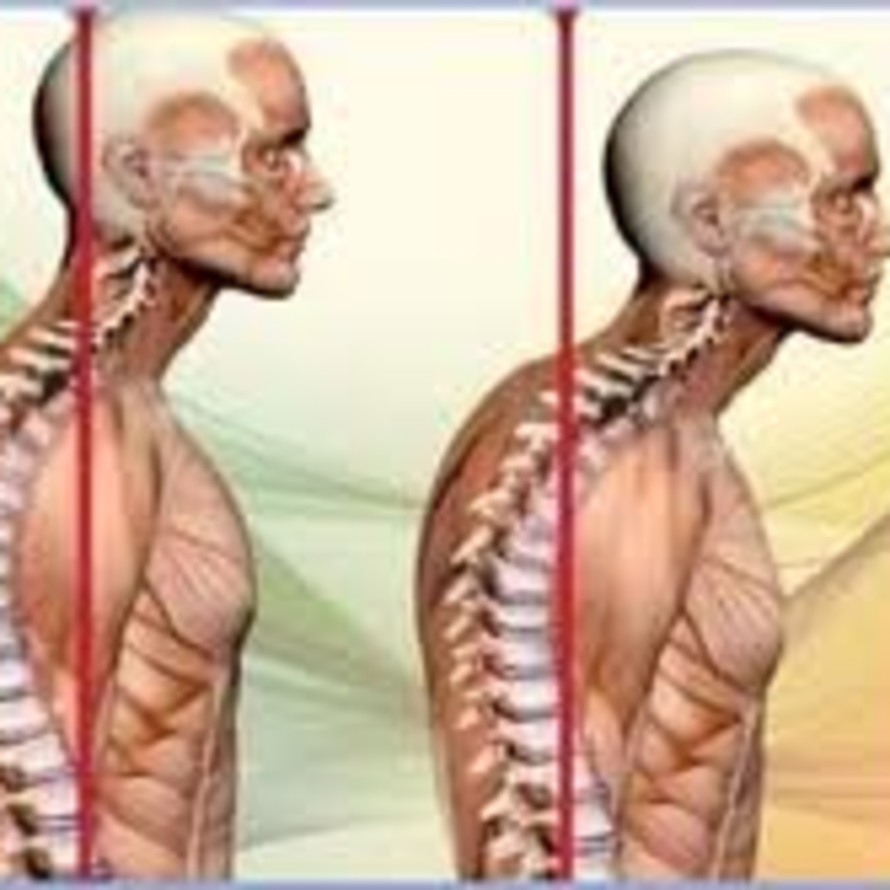 Episode 13 : Can poor posture cause pain? IMO - hell yes!